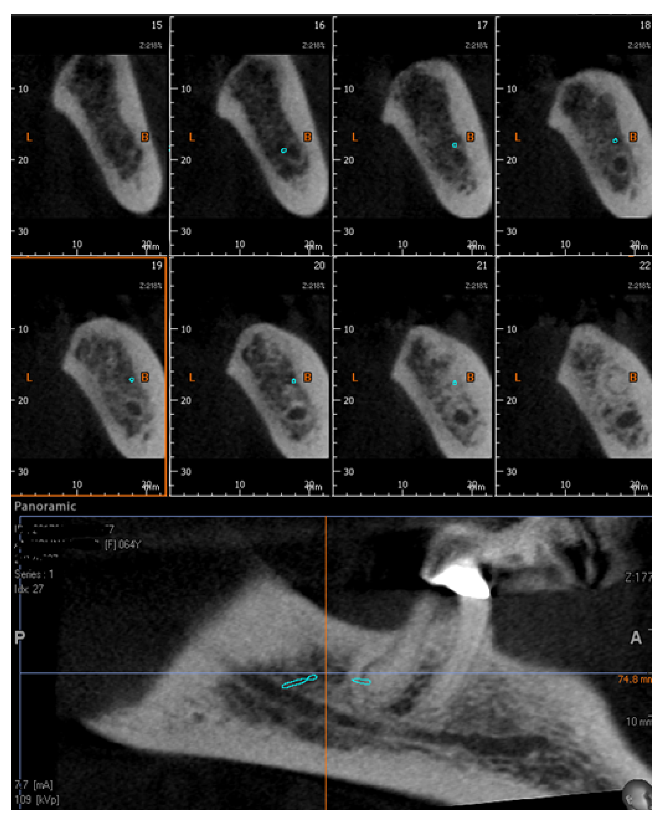 Diagnostics 12 01885 g006