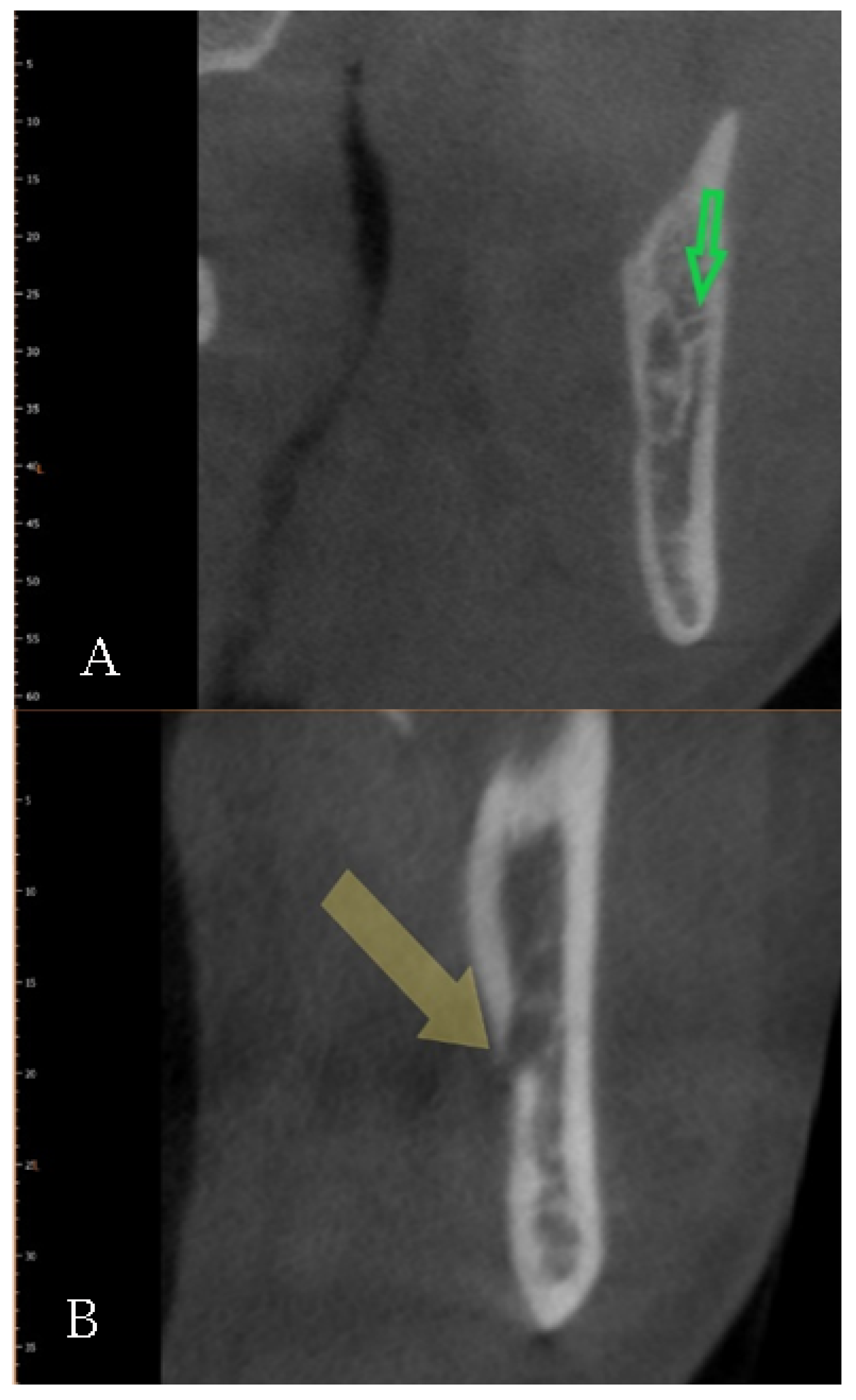 Diagnostics 12 01885 g009