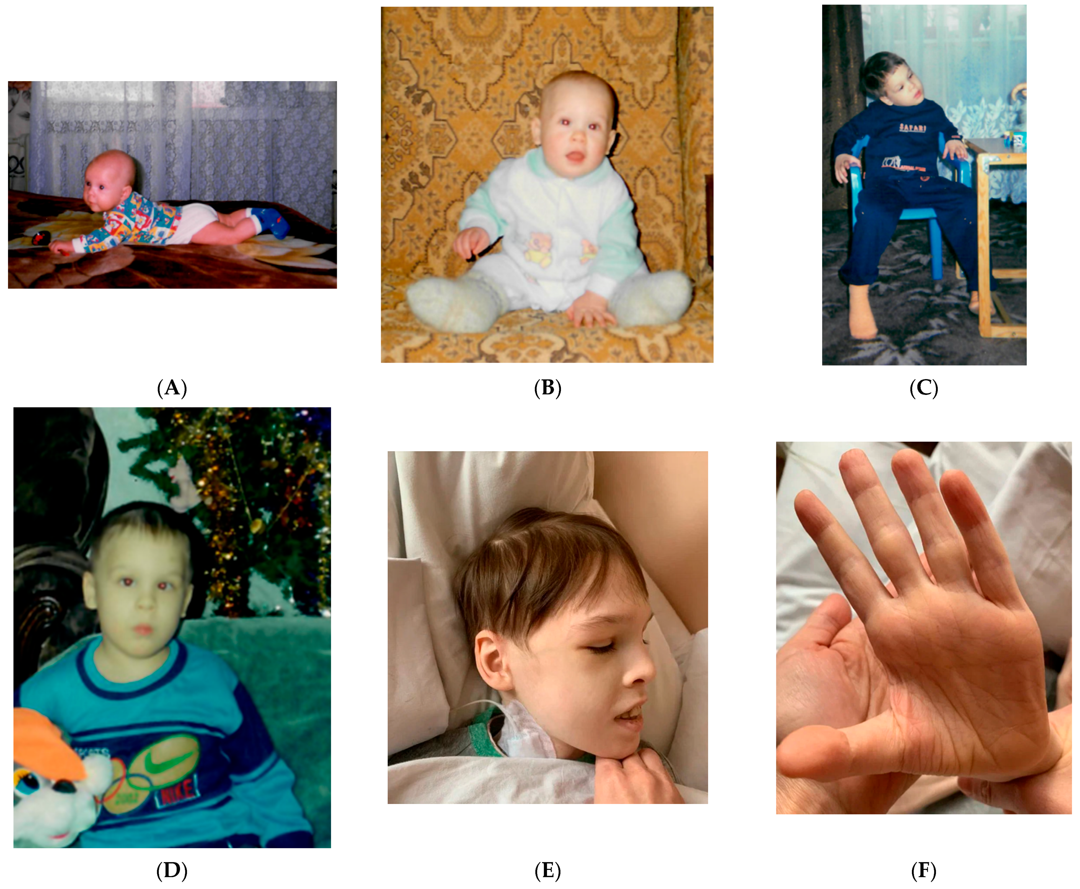 Diagnostics 12 01887 g002 550