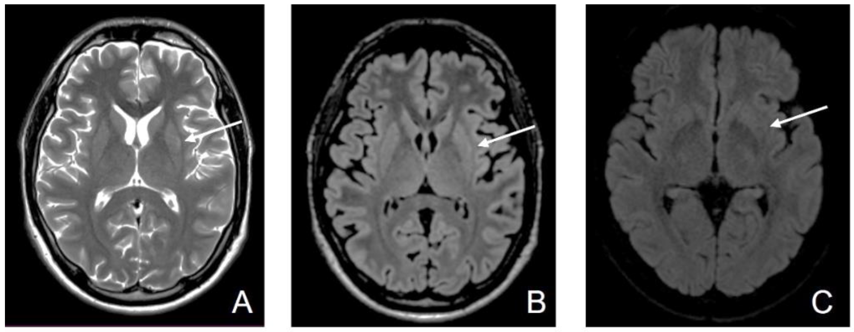 Diagnostics 12 01888 g005 550