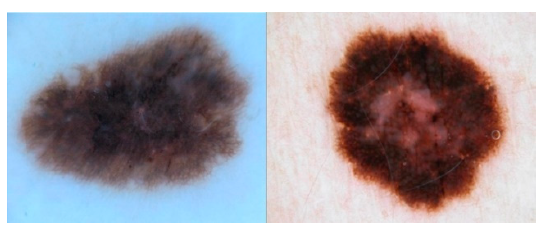 Diagnostics 12 01893 g001