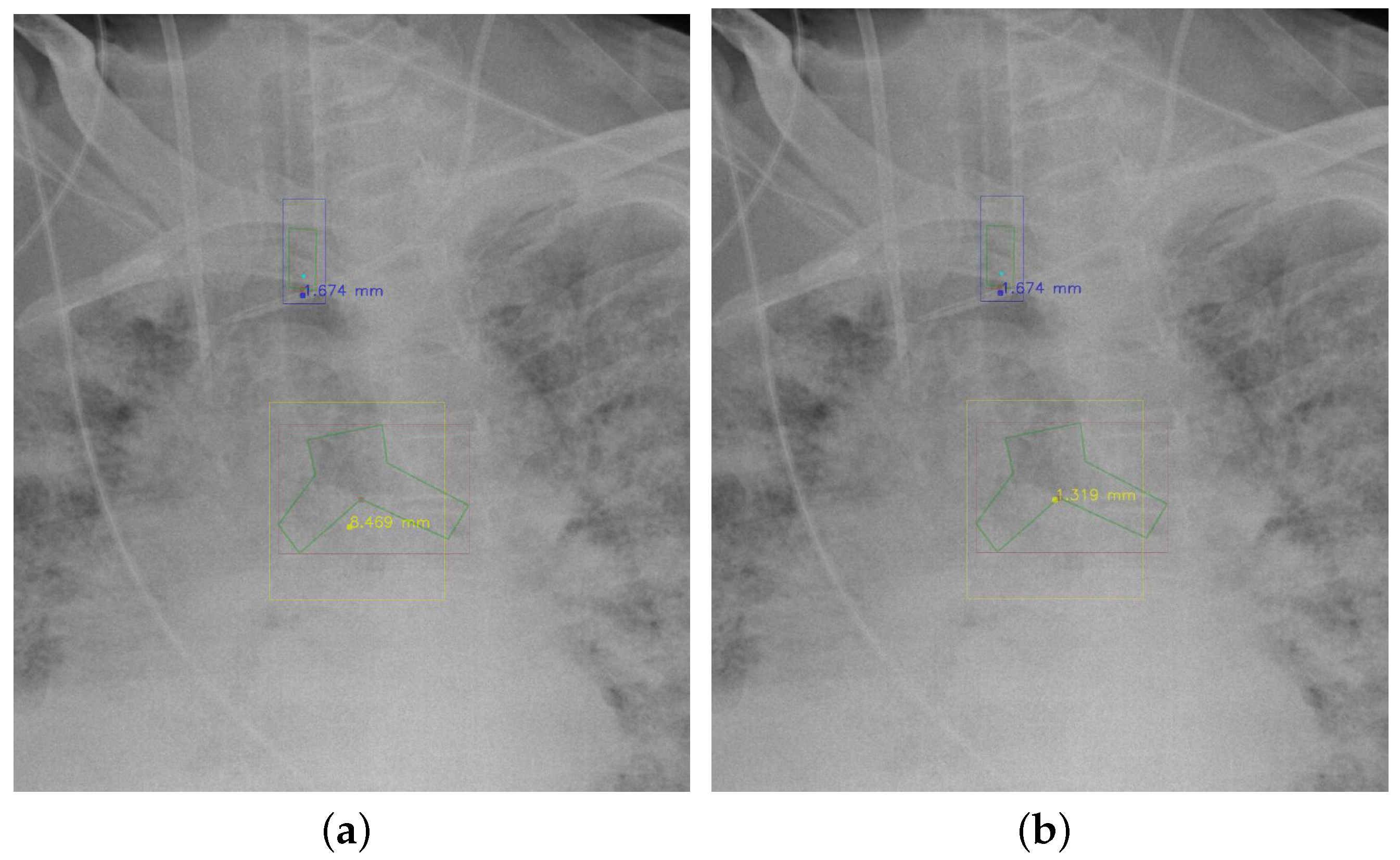 Diagnostics 12 01913 g008 550