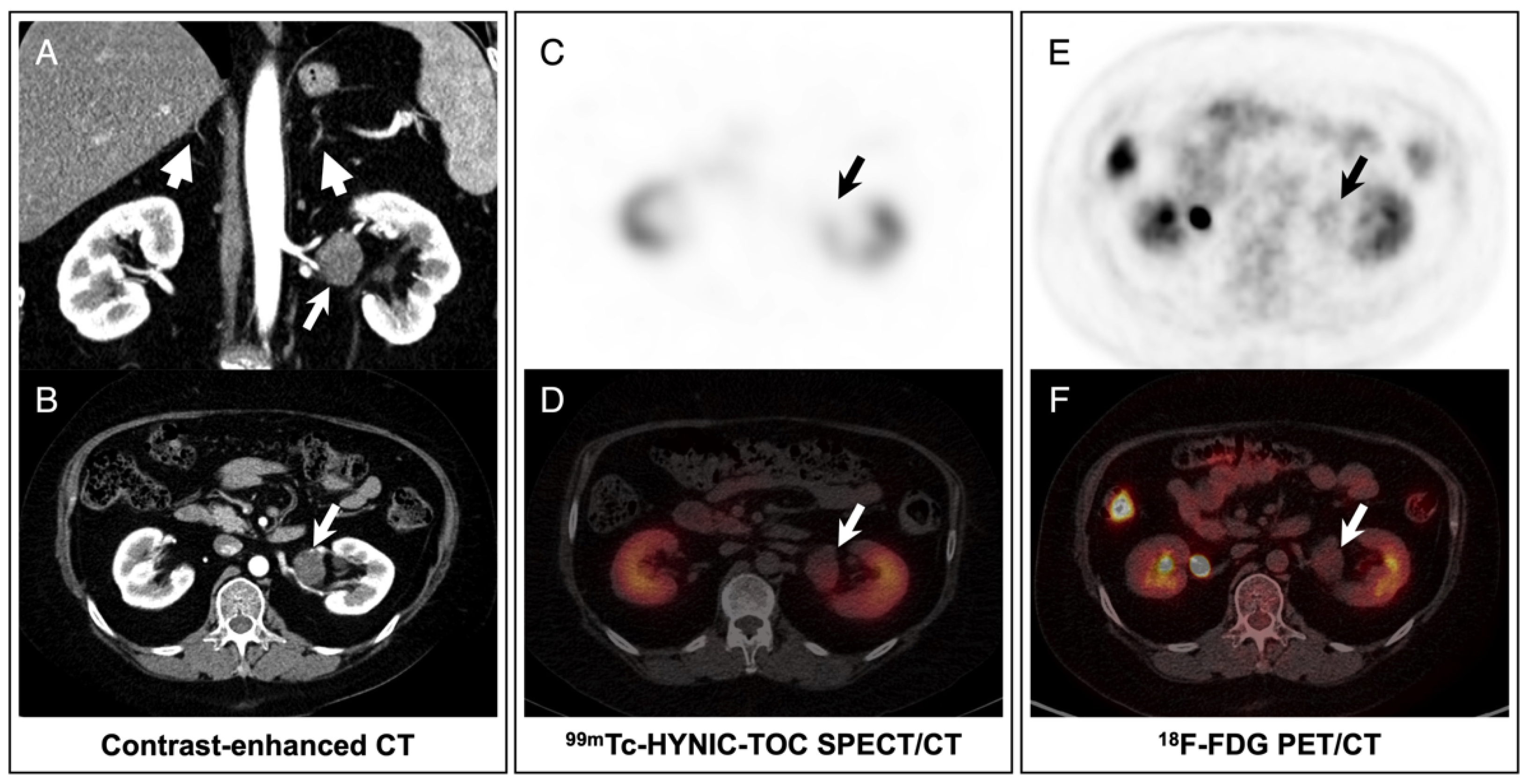 Diagnostics 12 01937 g001 550