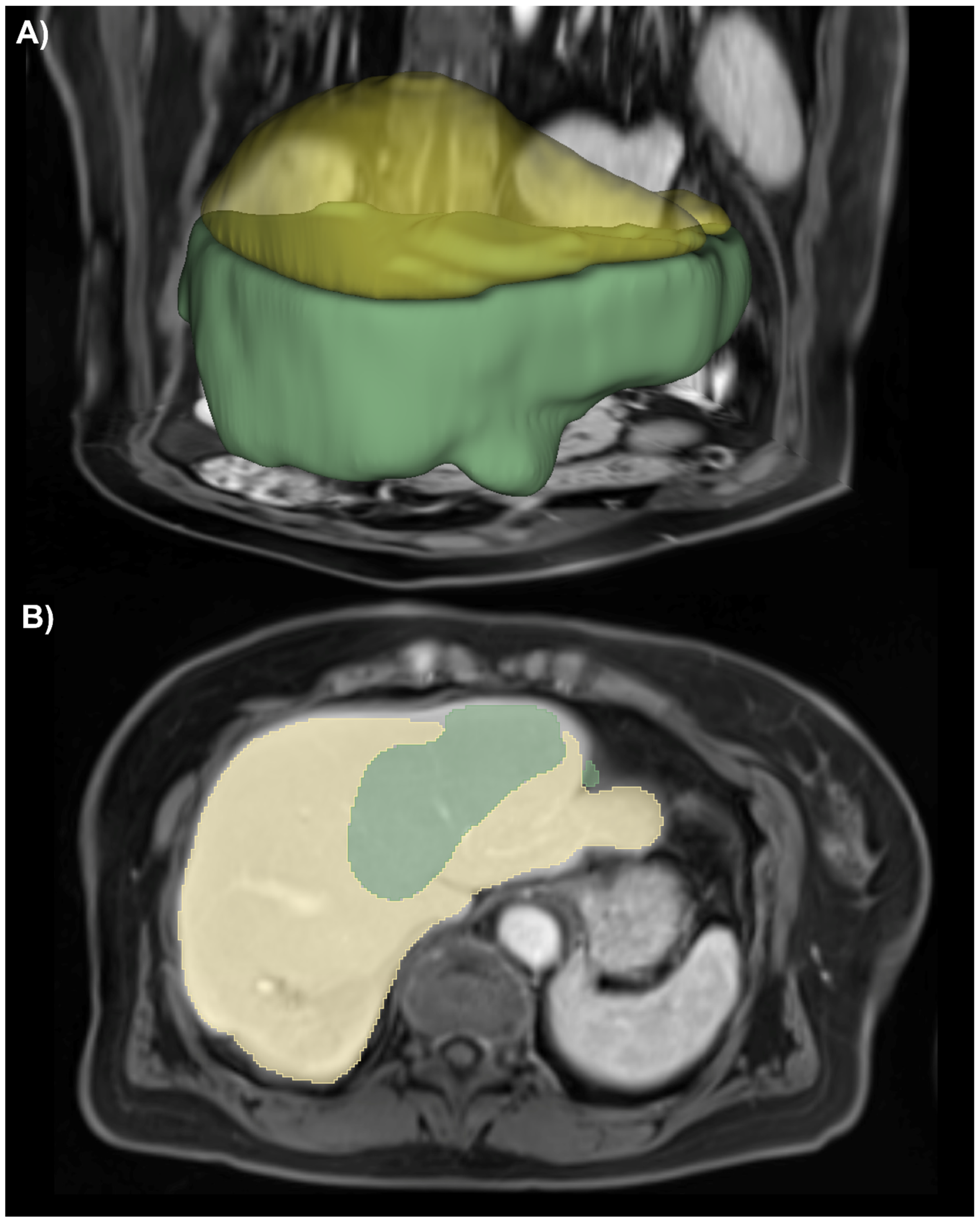 Diagnostics 12 01938 g004 550