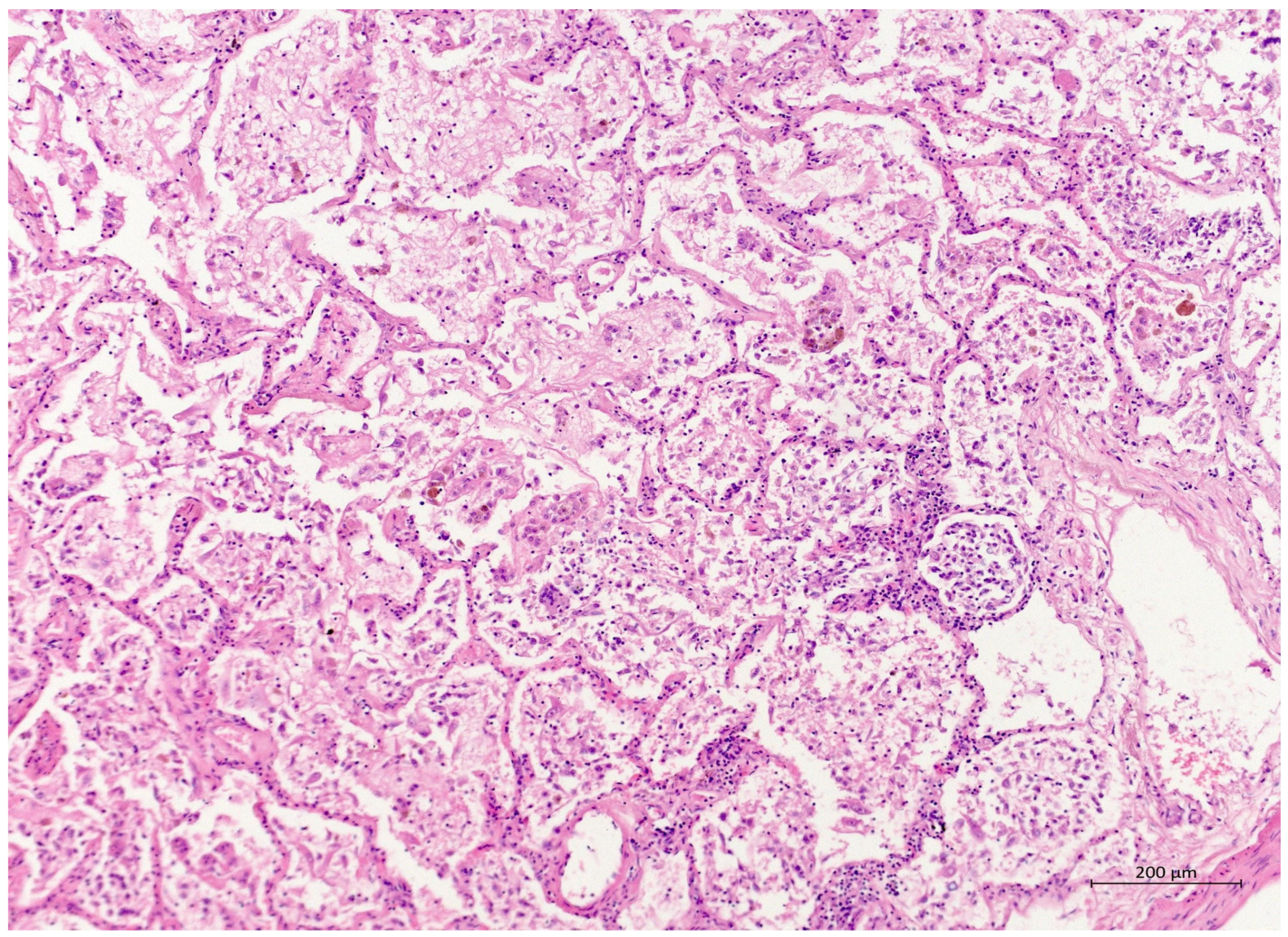 Diagnostics 12 01944 g002 550