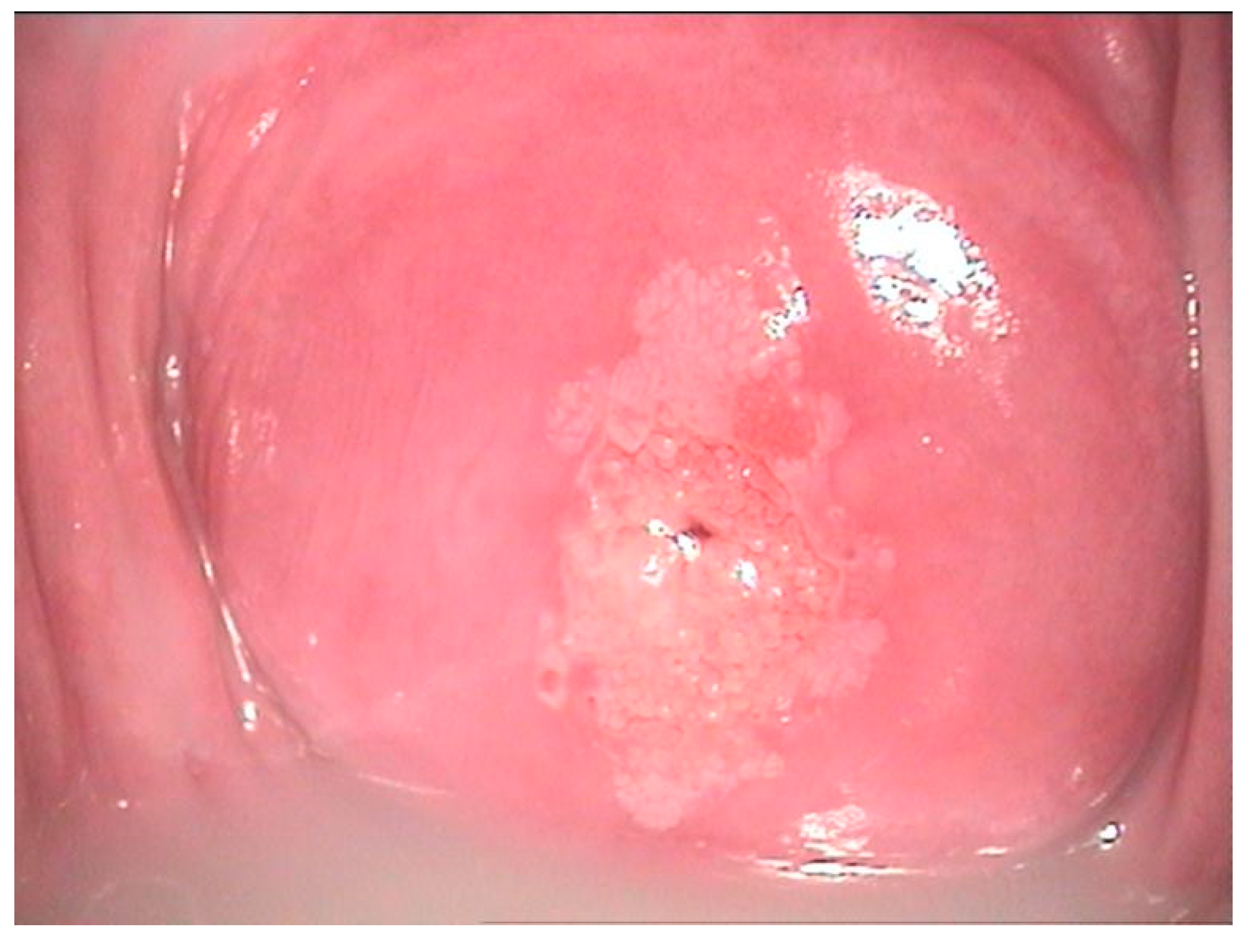 Diagnostics 12 01947 g002 550