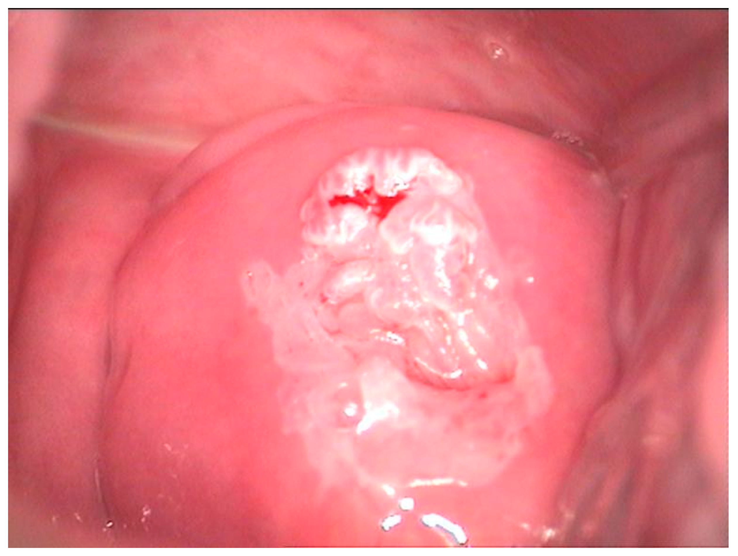 Diagnostics 12 01947 g004 550