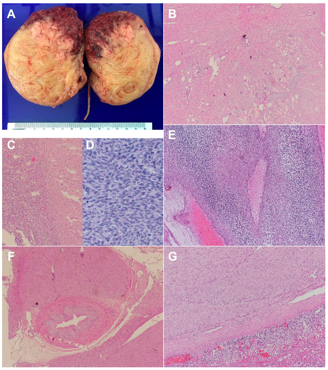 Diagnostics 12 01951 g002 Diagnostics 12 01951 g002