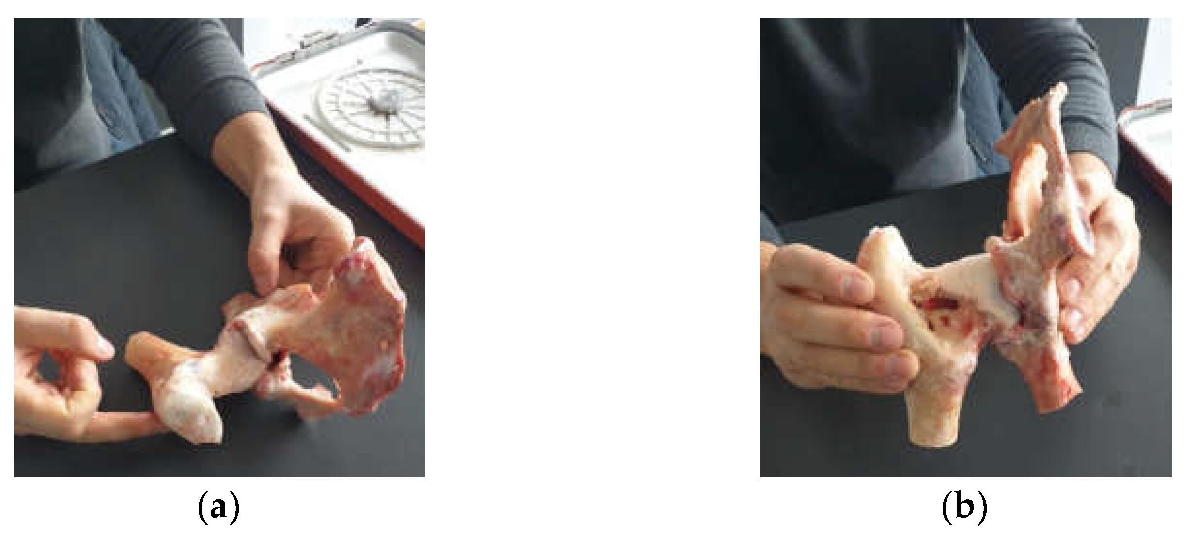 Diagnostics 12 01952 g001 550