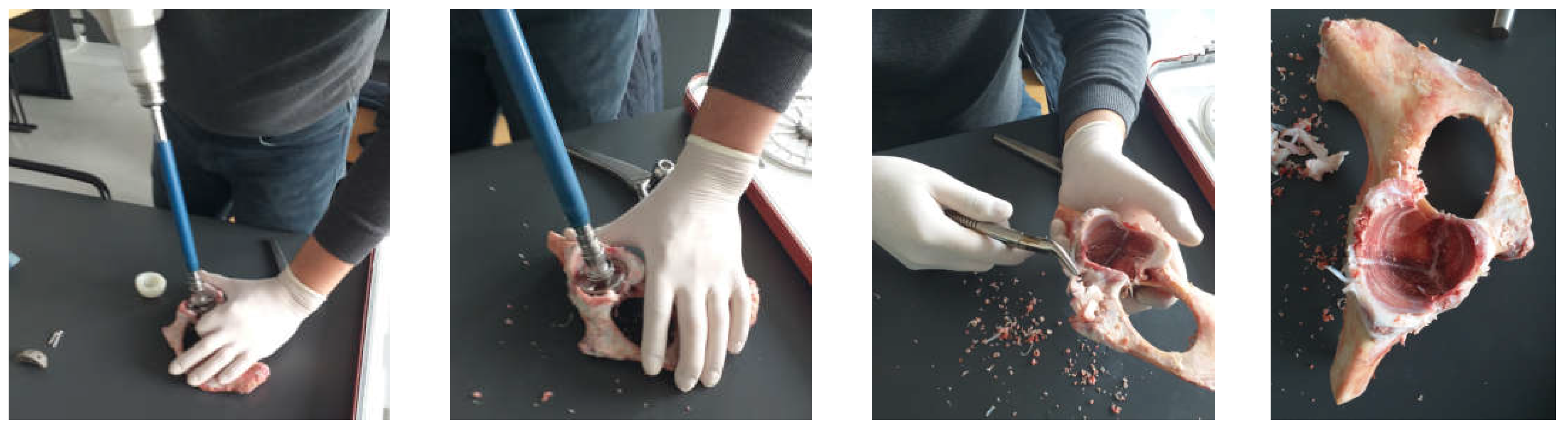 Diagnostics 12 01952 g003 550