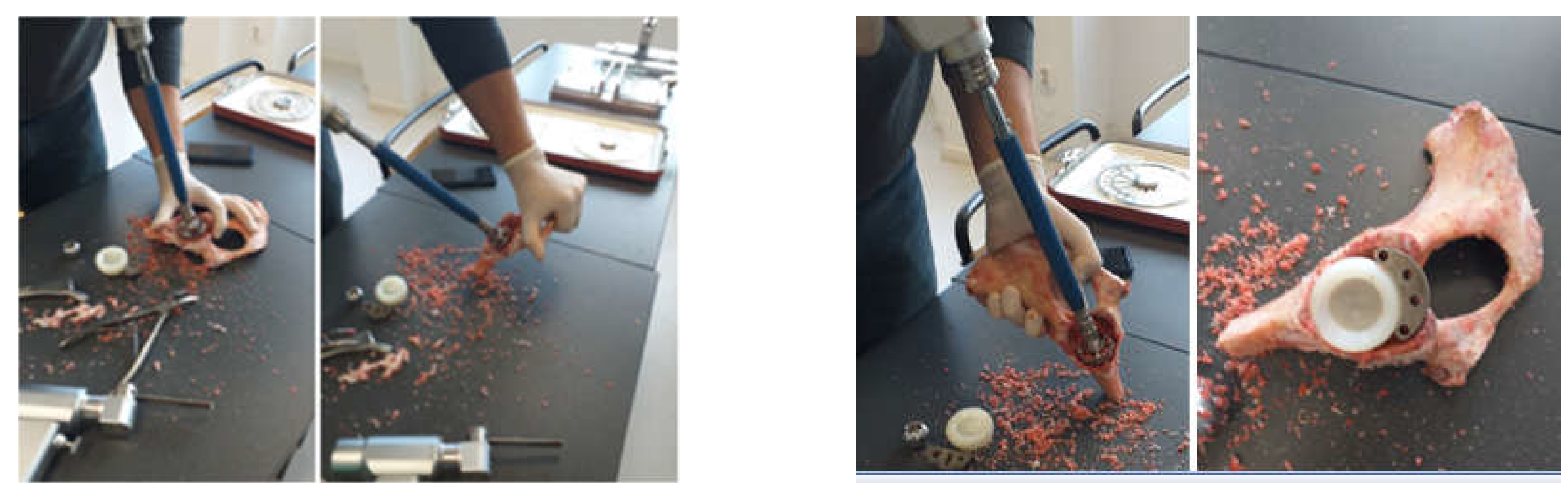 Diagnostics 12 01952 g004 550