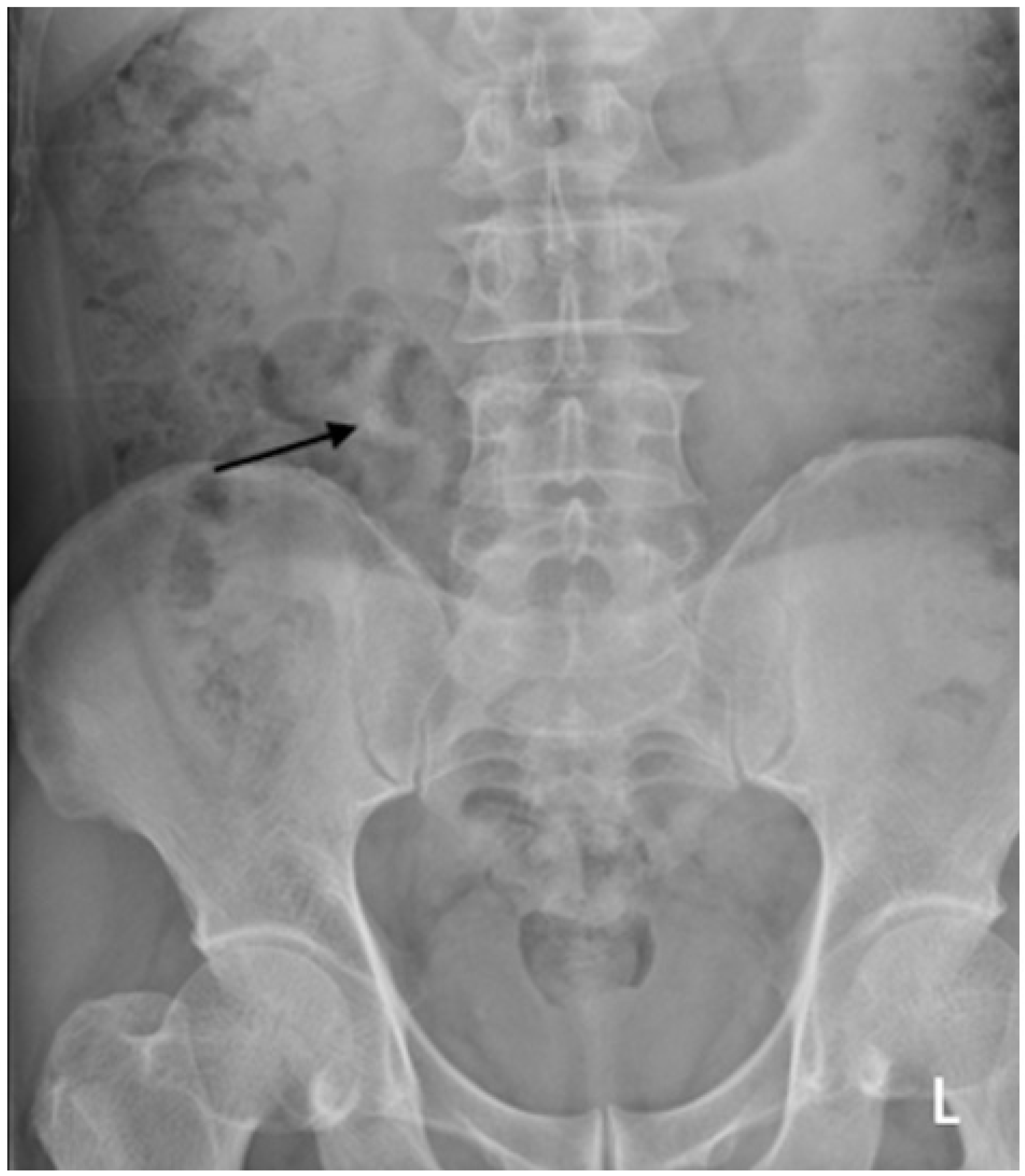 Diagnostics 12 01954 g004 550