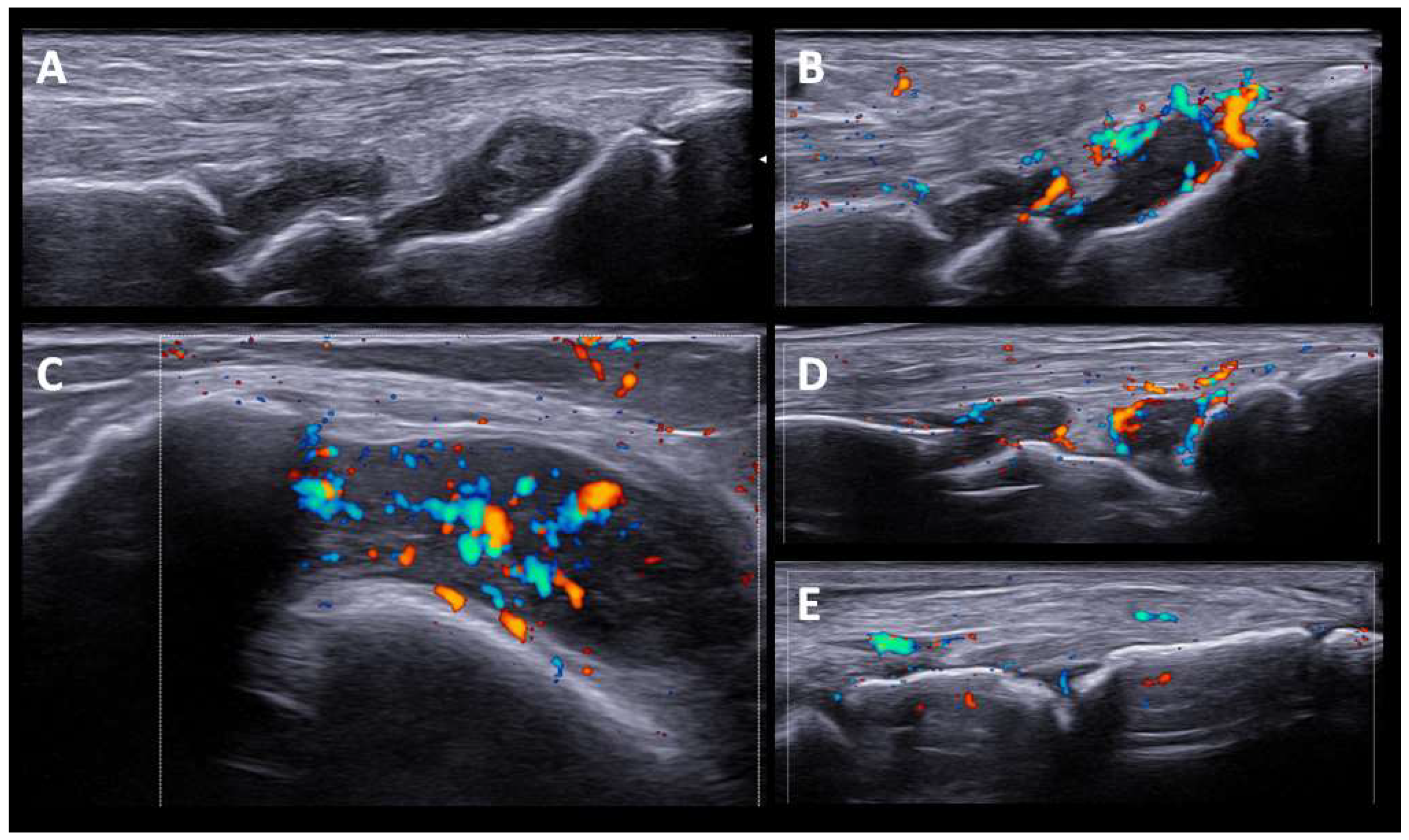 Diagnostics 12 01961 g001 550