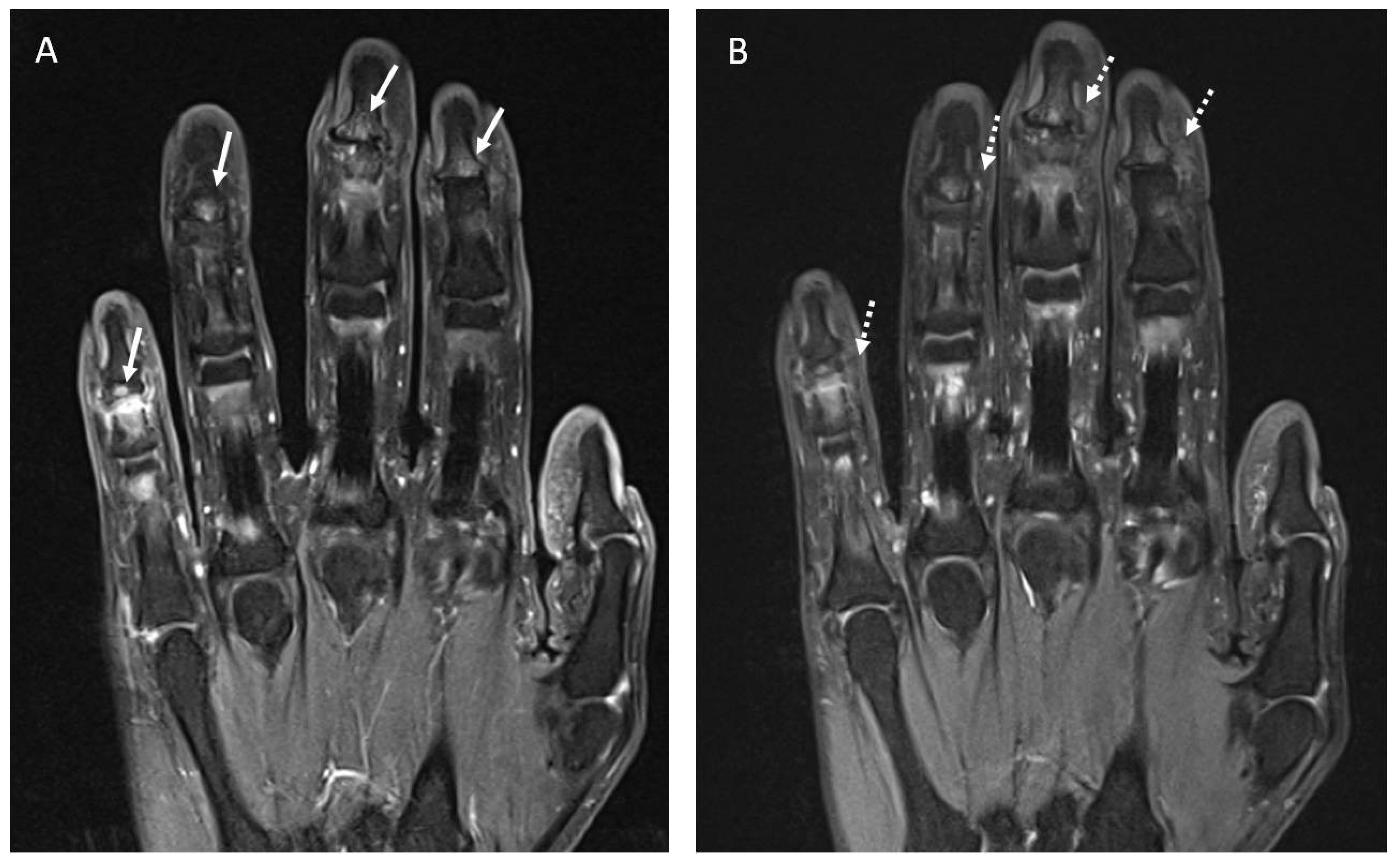 Diagnostics 12 01961 g005 550