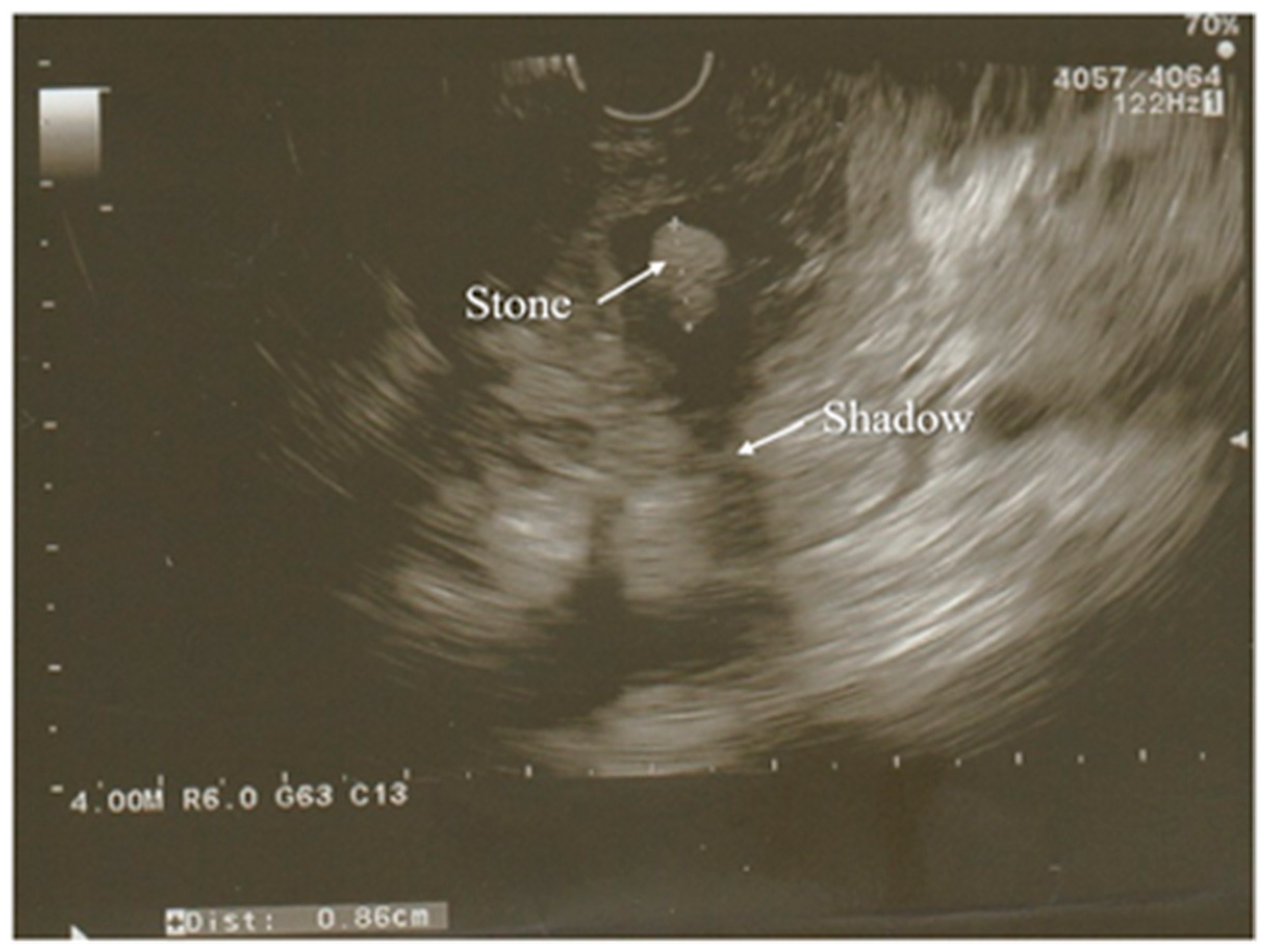 Diagnostics 12 01974 g002 Diagnostics 12 01974 g002