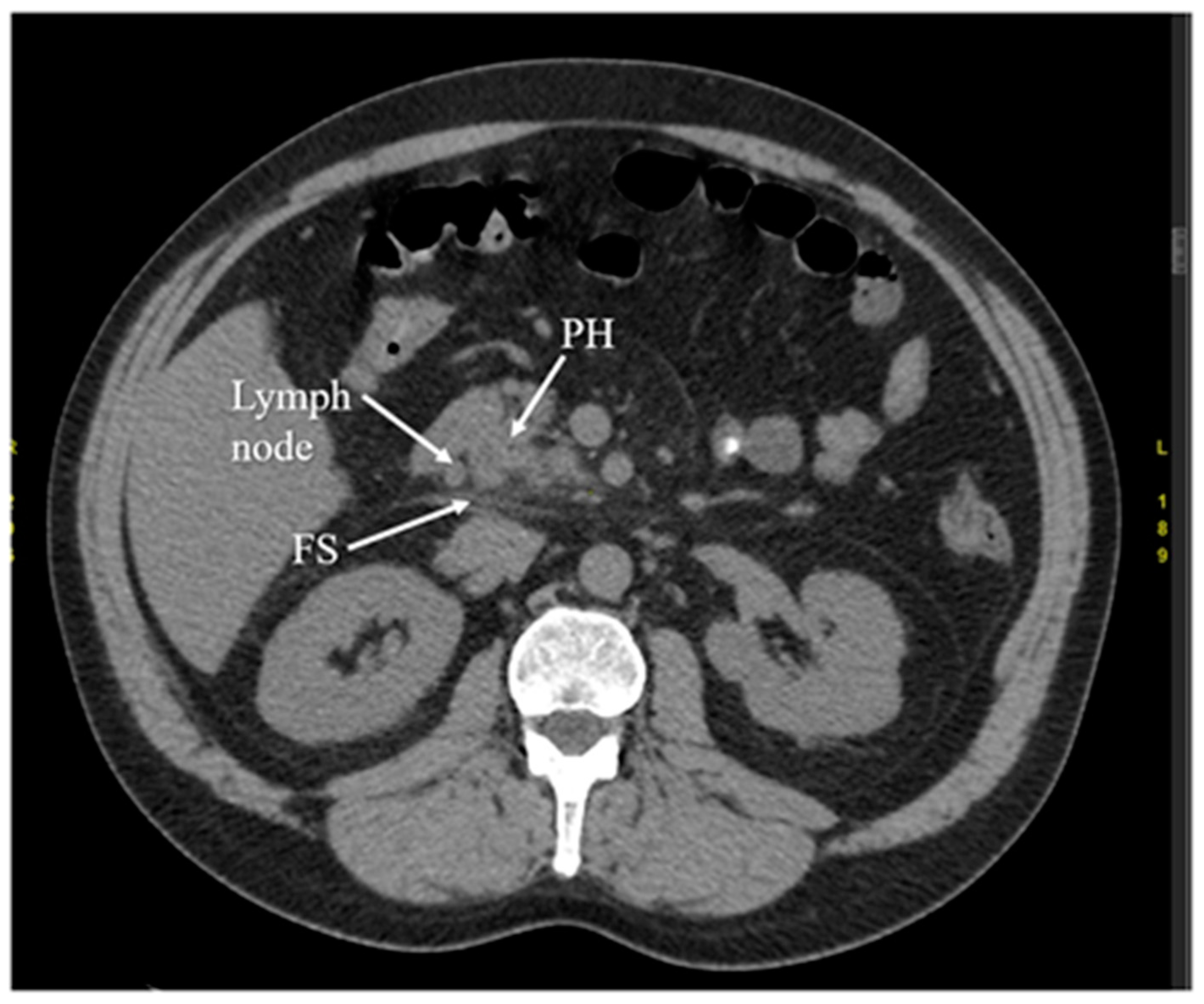 Diagnostics 12 01974 g003 Diagnostics 12 01974 g003