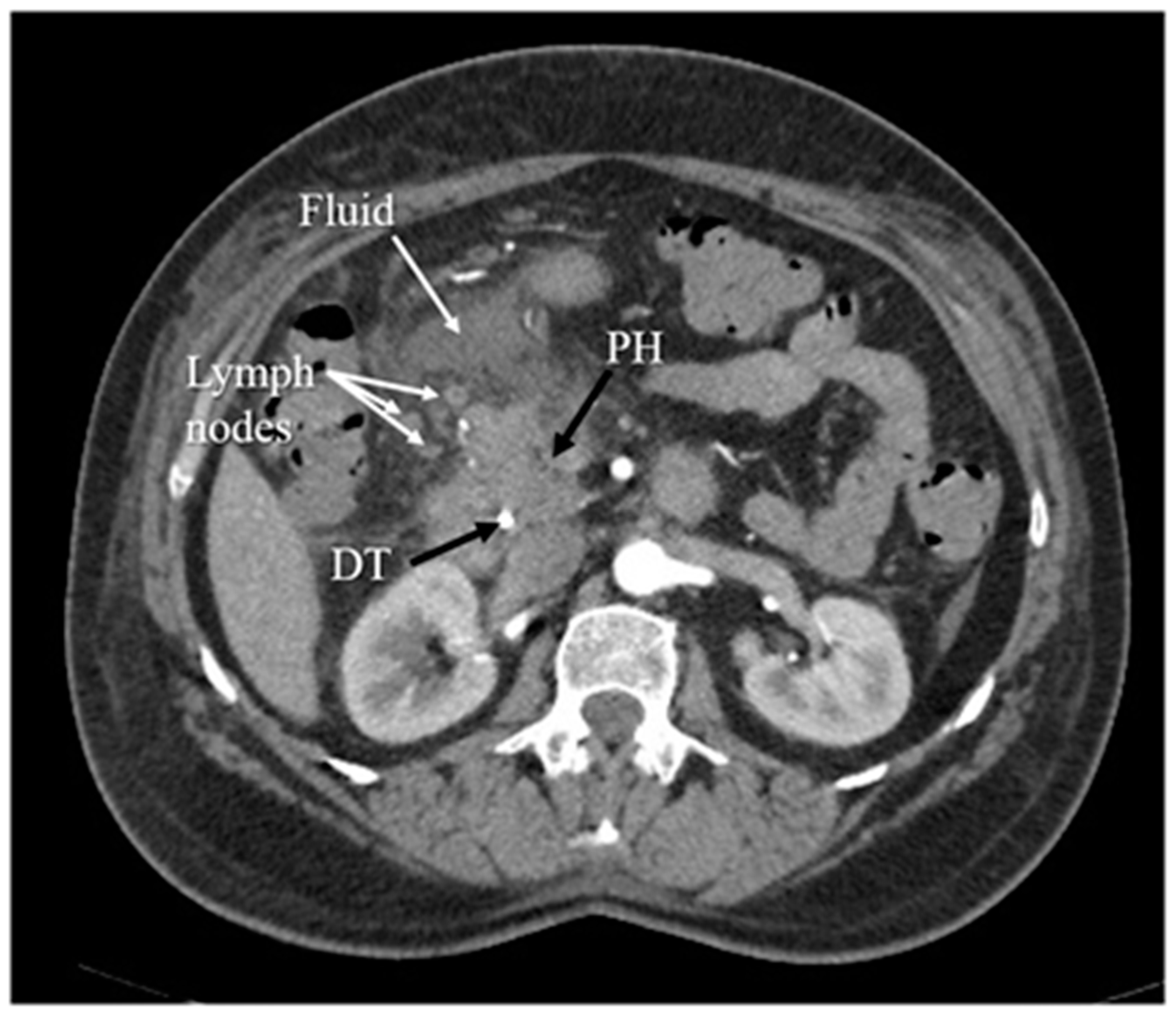 Diagnostics 12 01974 g004 Diagnostics 12 01974 g004
