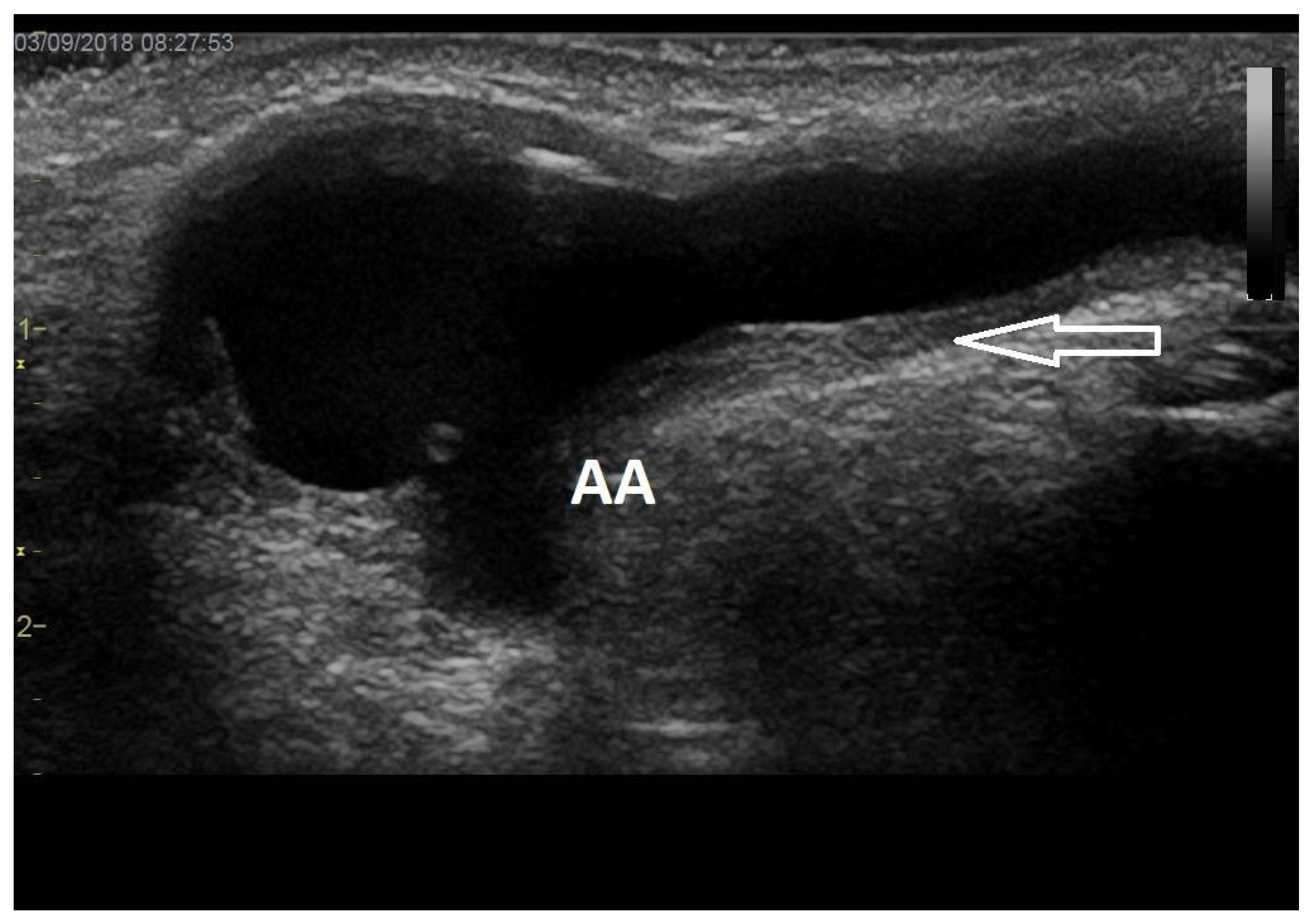 Diagnostics 12 01979 g002