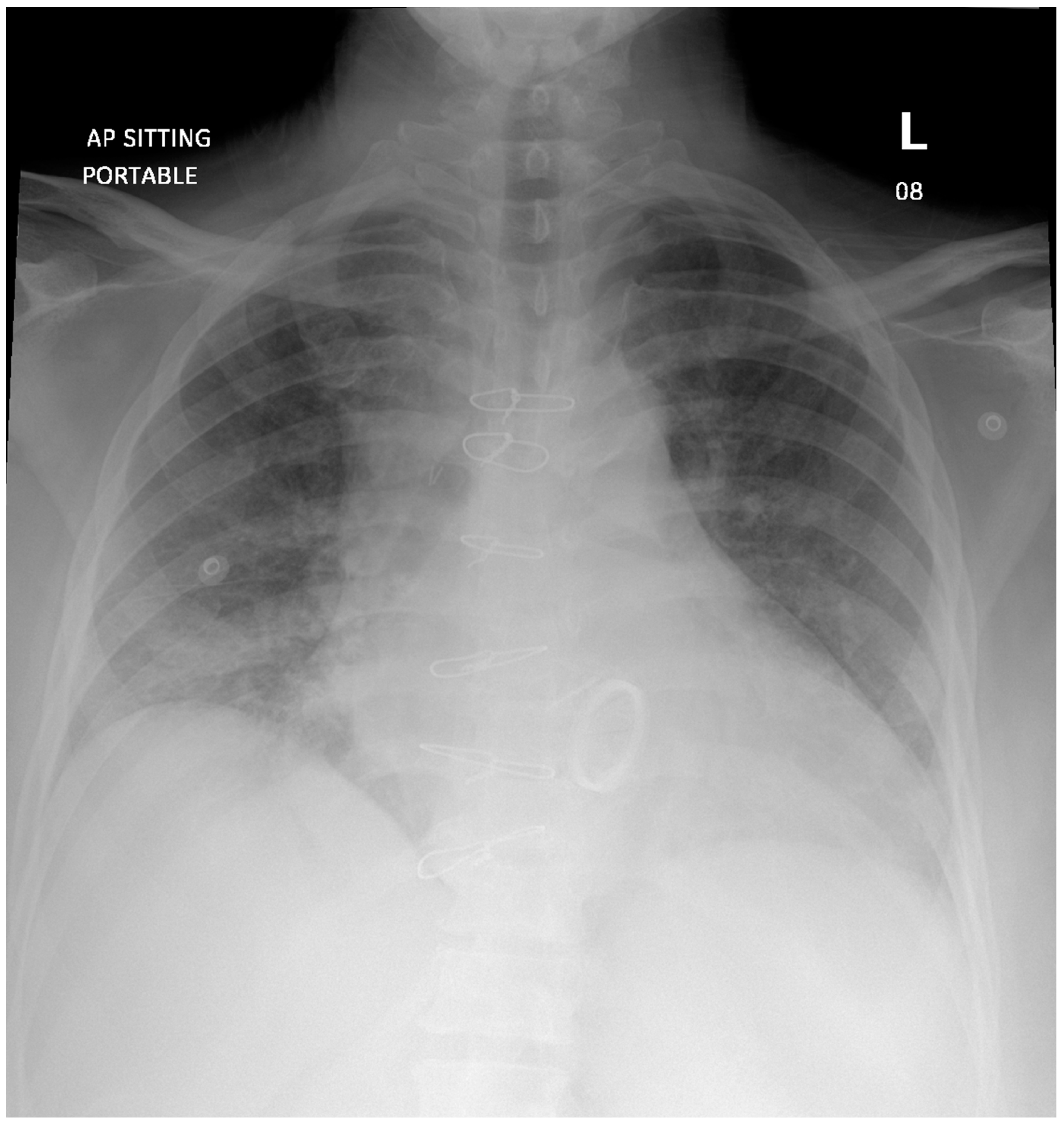 Diagnostics 12 01982 g001 Diagnostics 12 01982 g001