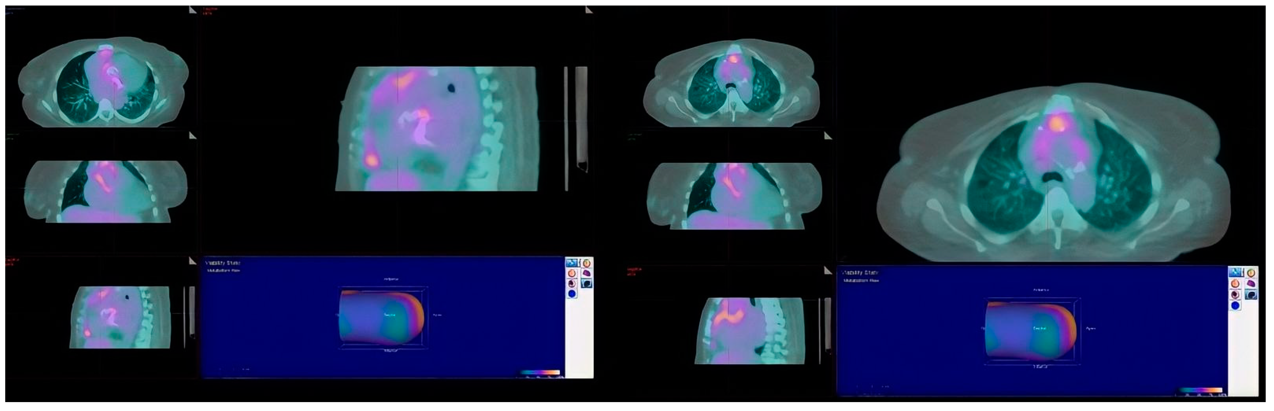 Diagnostics 12 01982 g003 Diagnostics 12 01982 g003