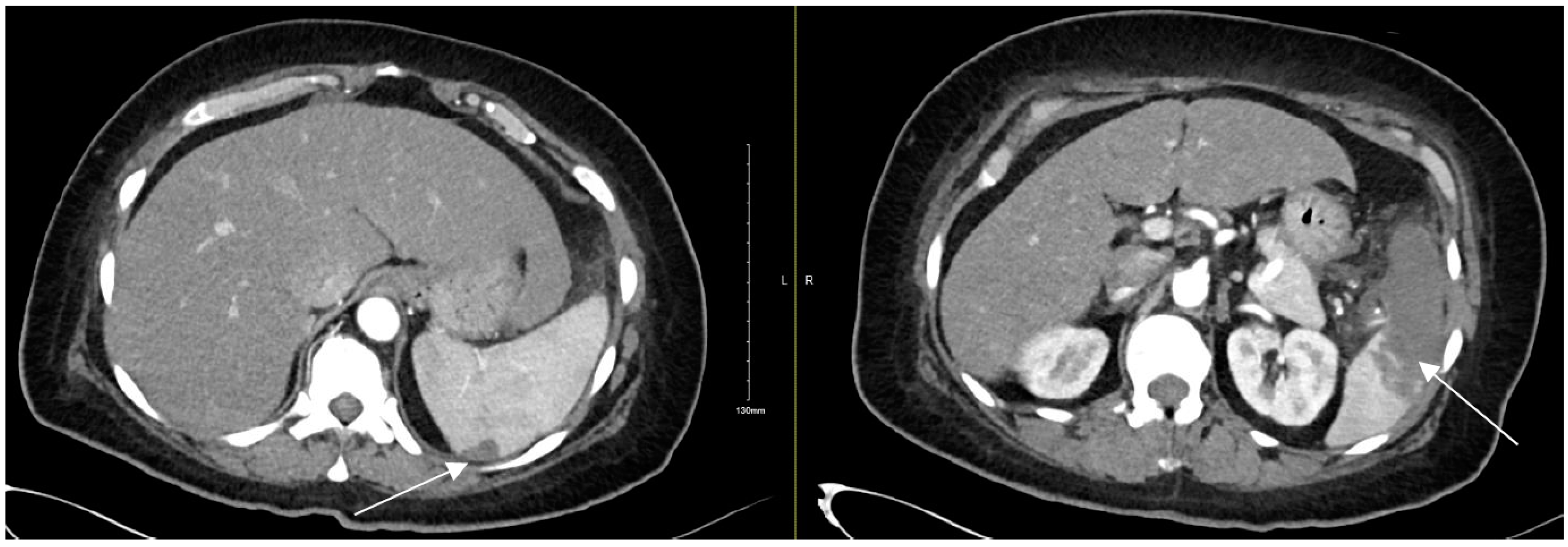Diagnostics 12 01982 g006 Diagnostics 12 01982 g006