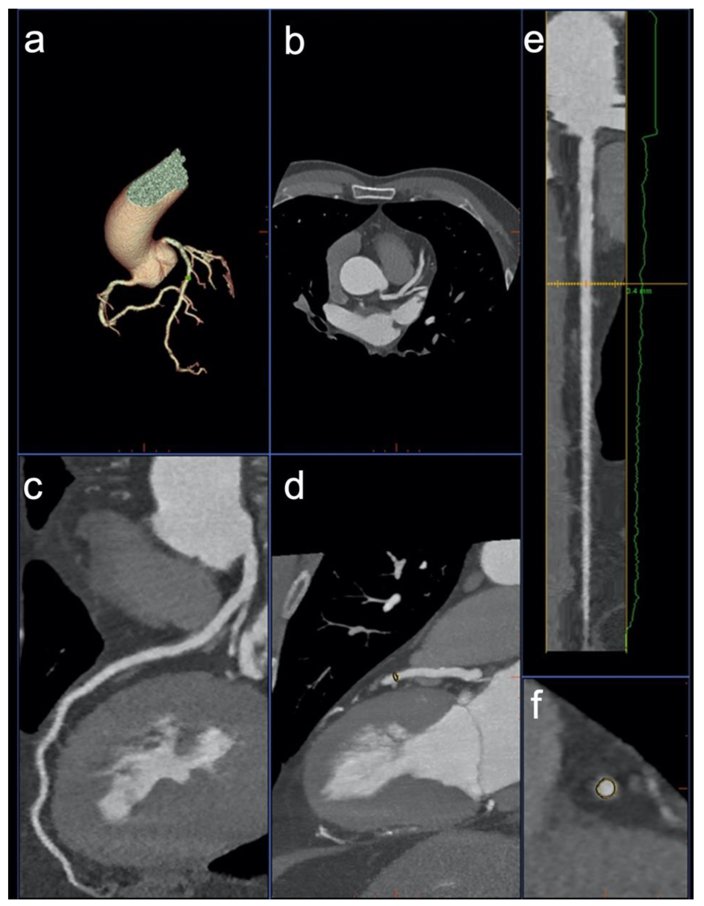 Diagnostics 12 01987 g001 Diagnostics 12 01987 g001