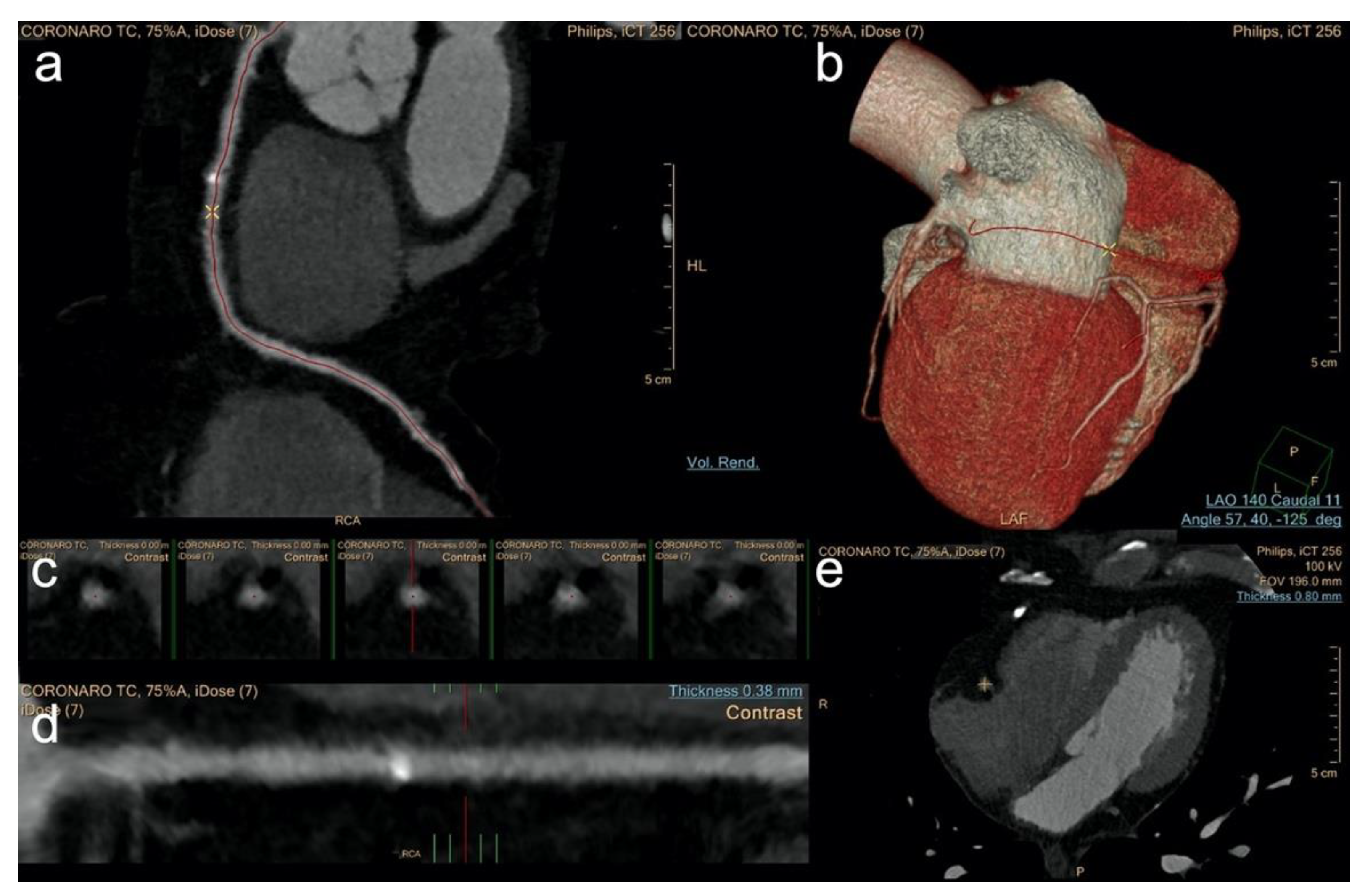 Diagnostics 12 01987 g002 Diagnostics 12 01987 g002