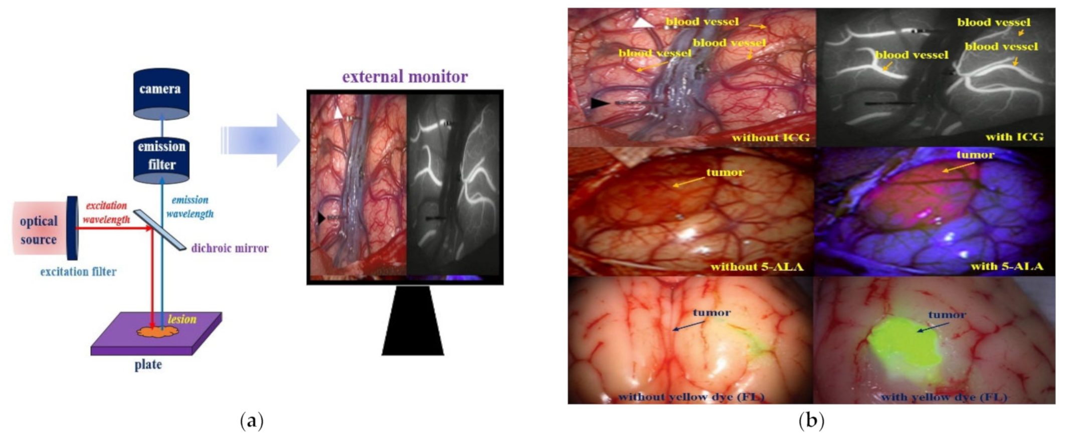 Diagnostics Free FullText Reduction of Specular Reflection Based