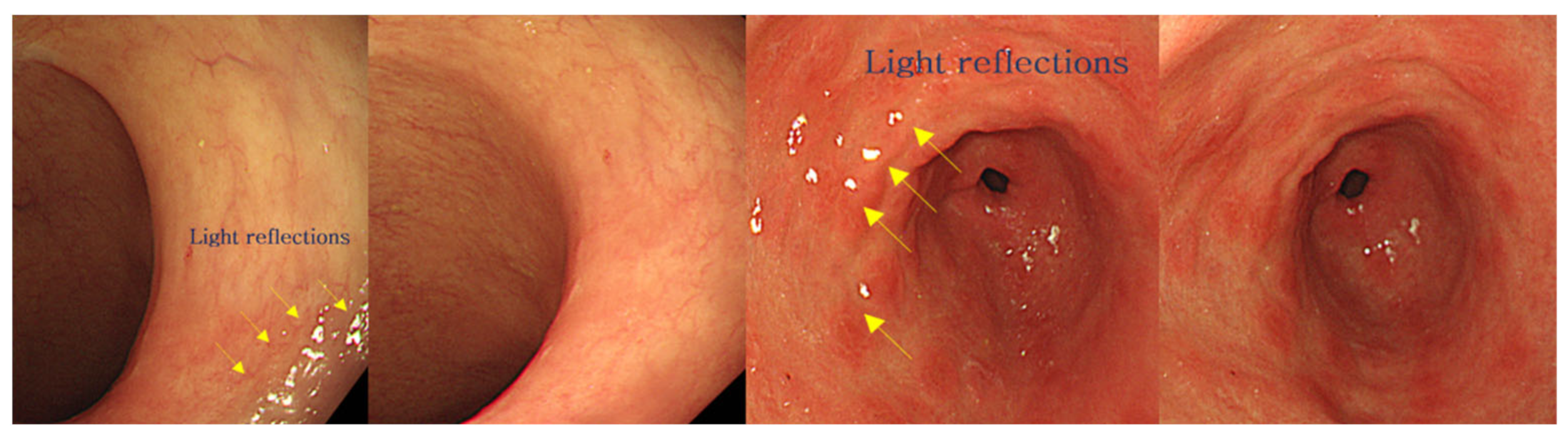 Diagnostics 12 01990 g007 550