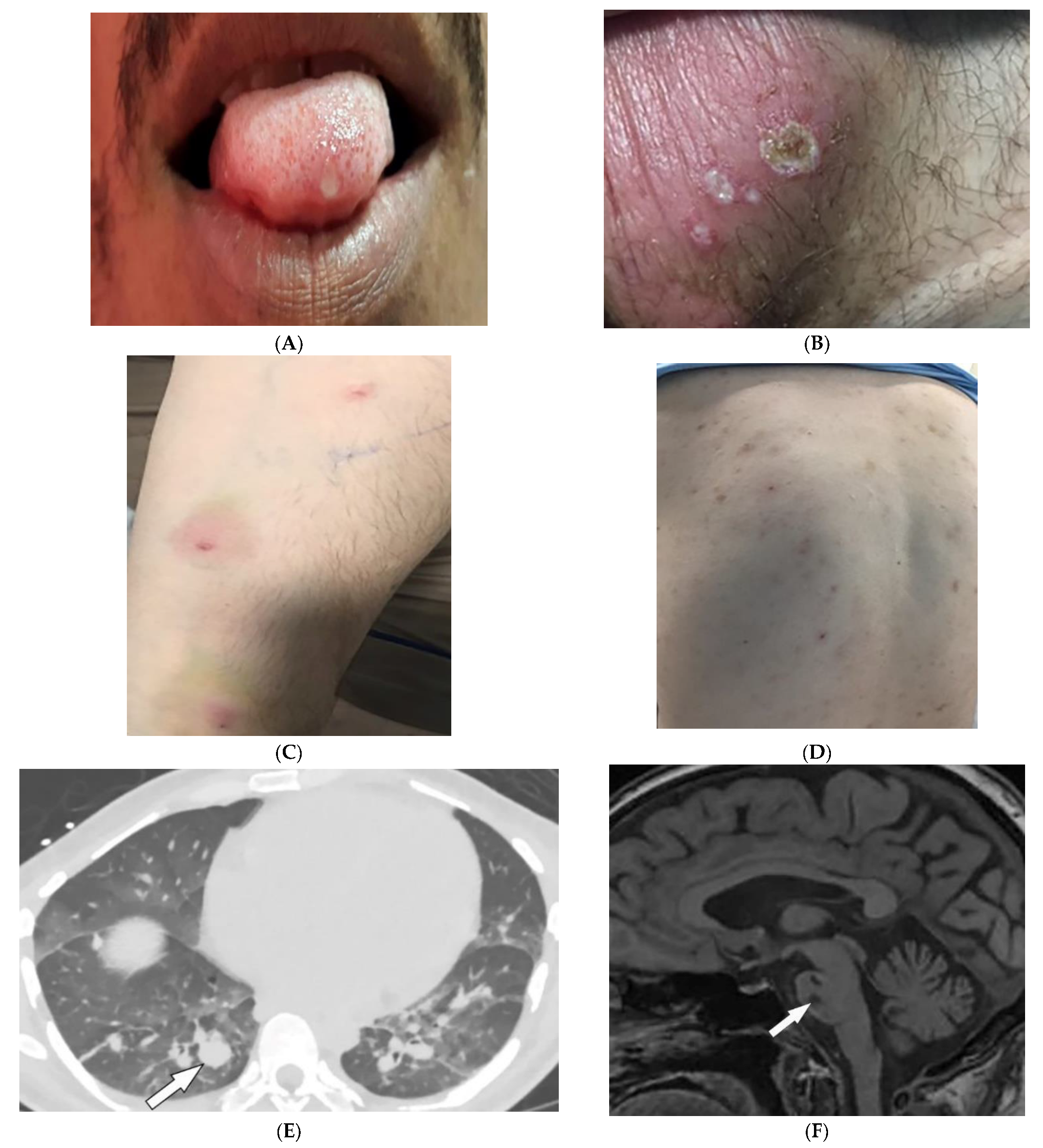 Diagnostics 12 02011 g007 Diagnostics 12 02011 g007