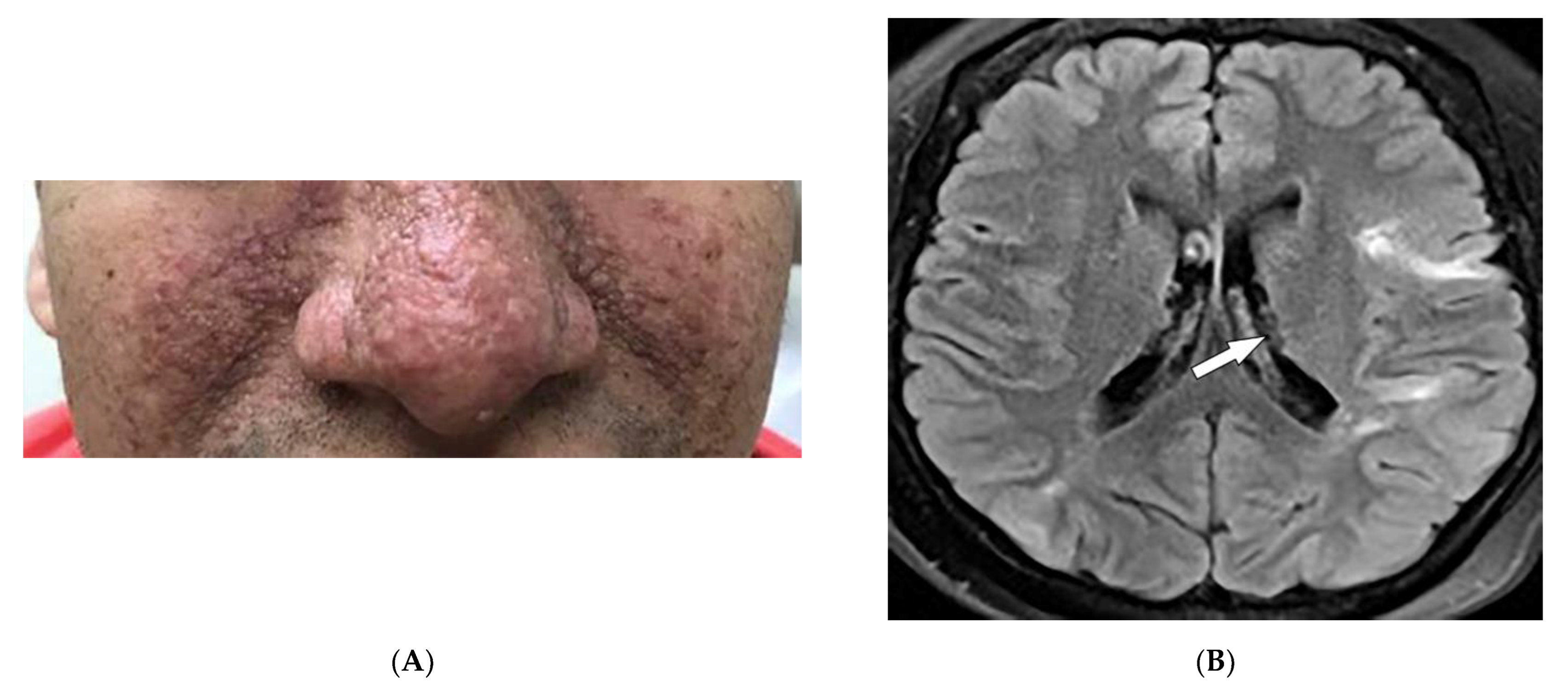 Diagnostics 12 02011 g008a Diagnostics 12 02011 g008a