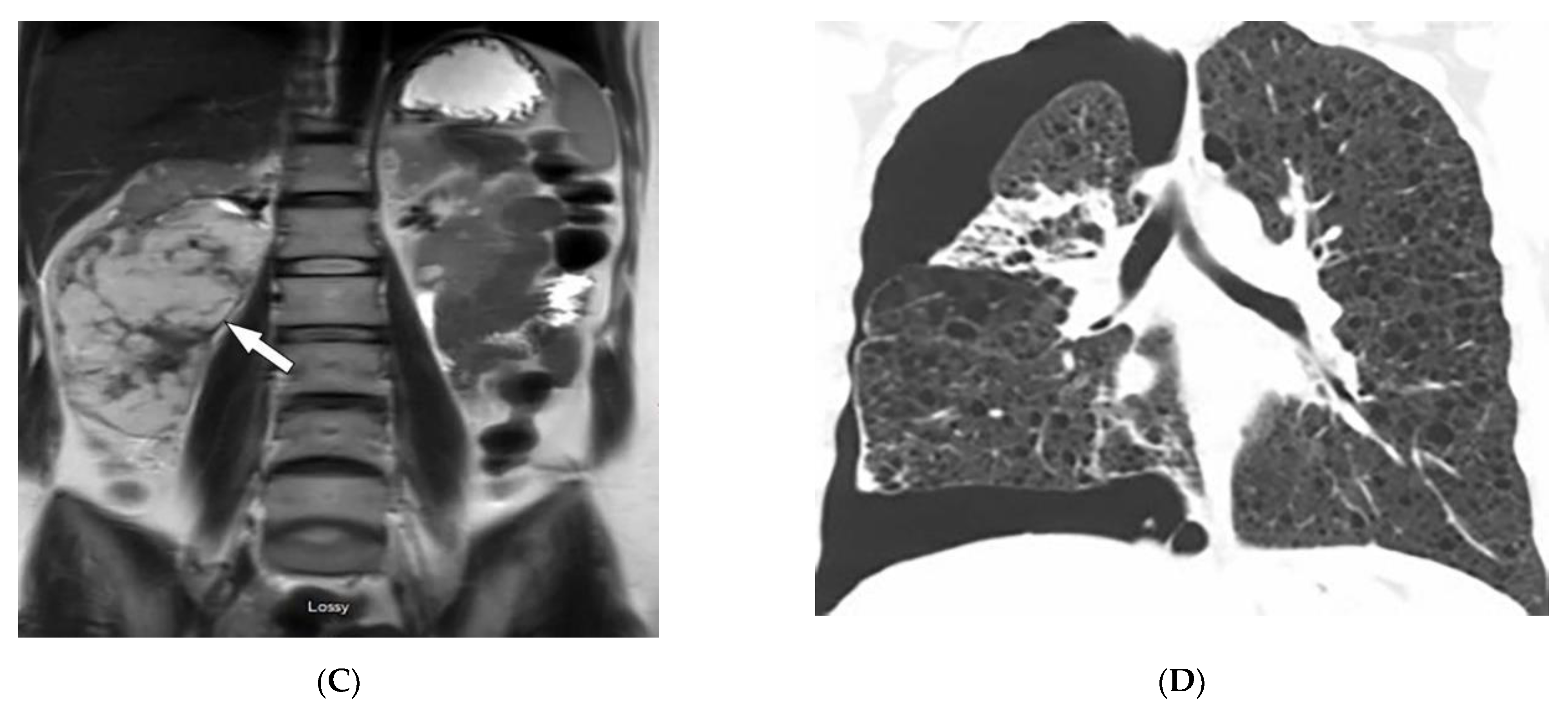 Diagnostics 12 02011 g008b Diagnostics 12 02011 g008b