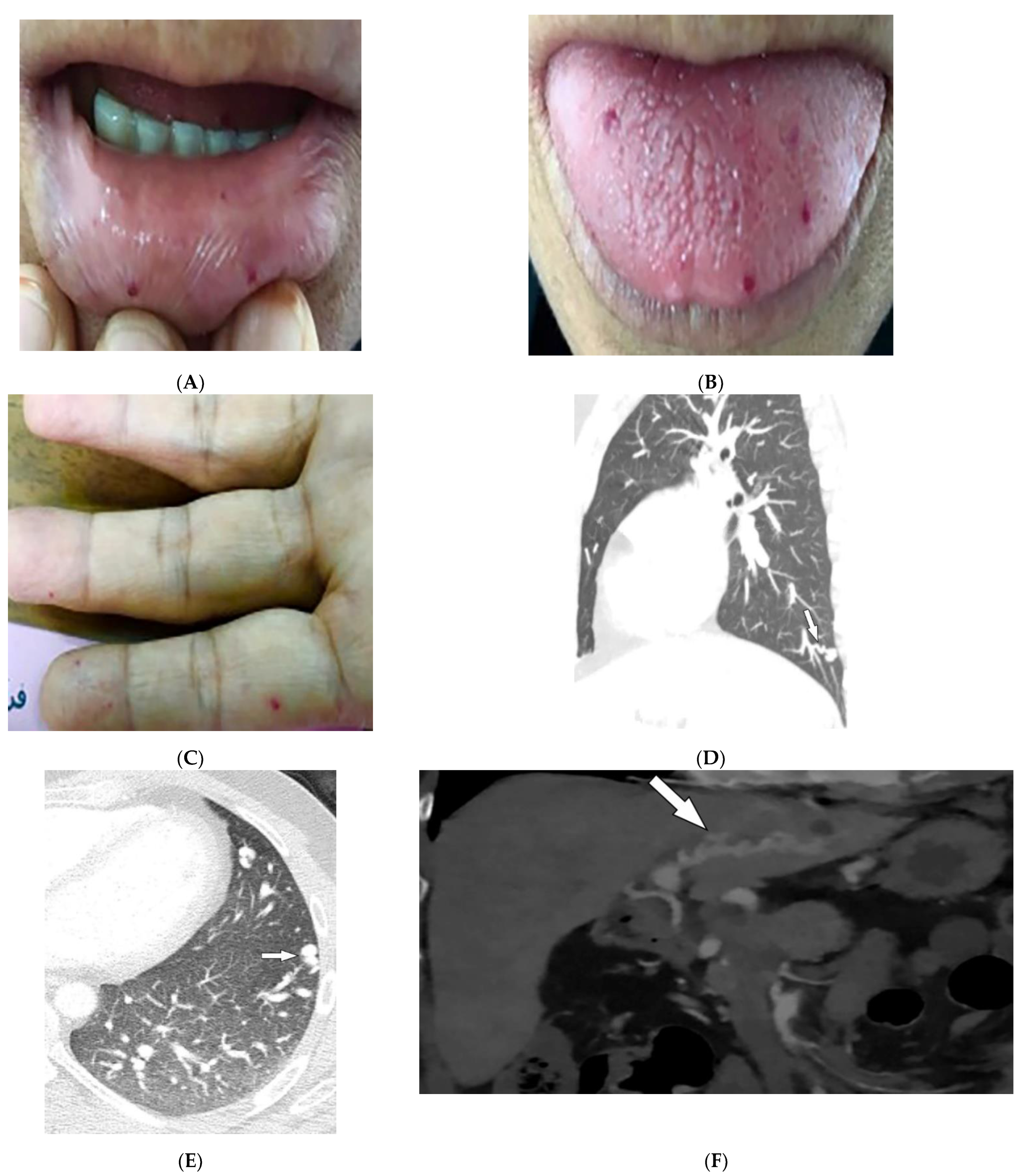 Diagnostics 12 02011 g013 Diagnostics 12 02011 g013