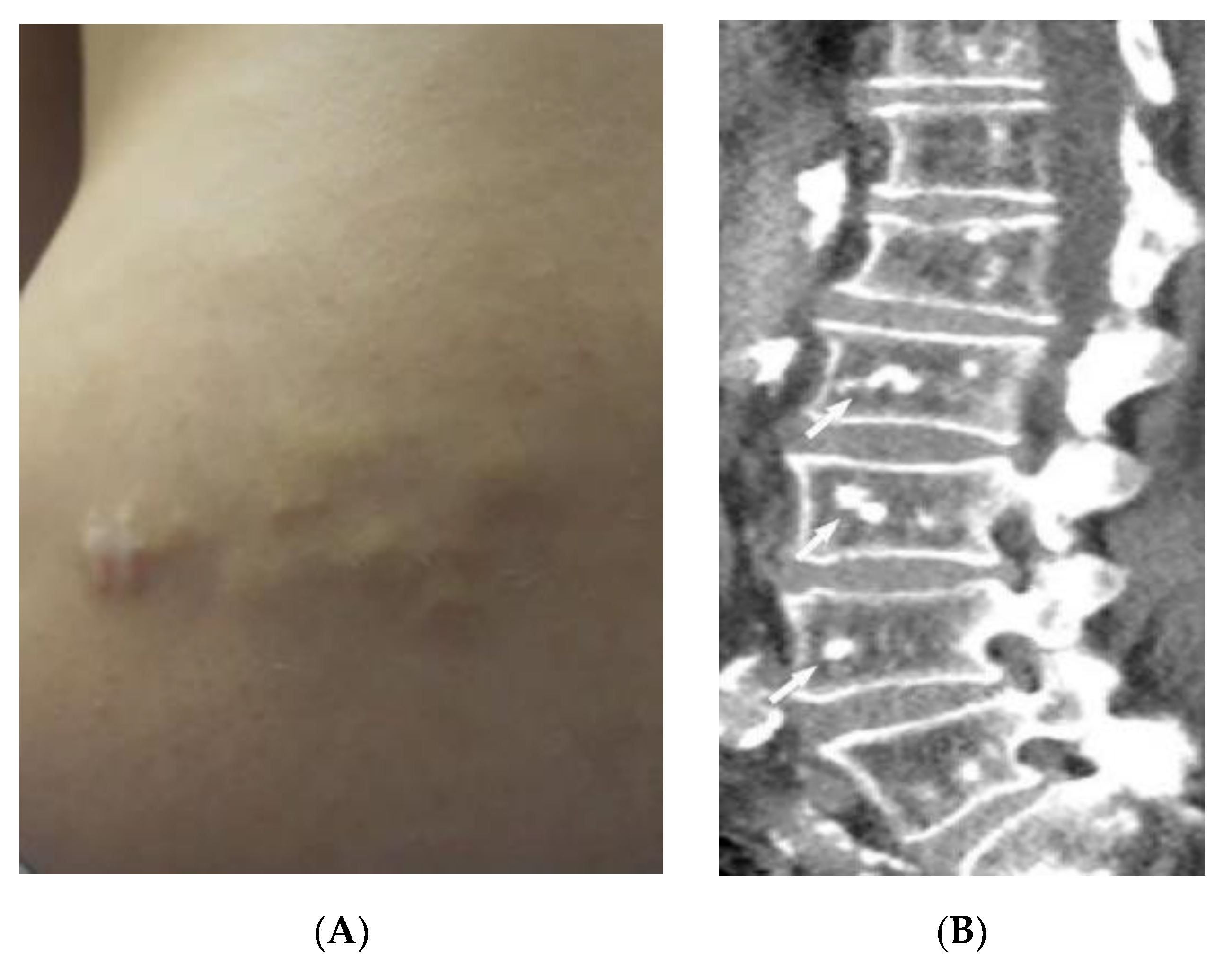 Diagnostics 12 02011 g018a Diagnostics 12 02011 g018a