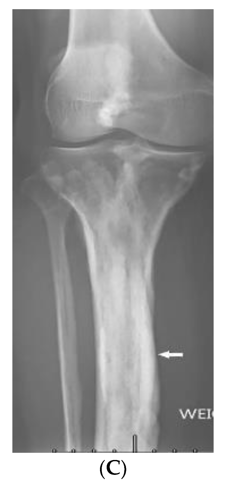 Diagnostics 12 02011 g018b Diagnostics 12 02011 g018b