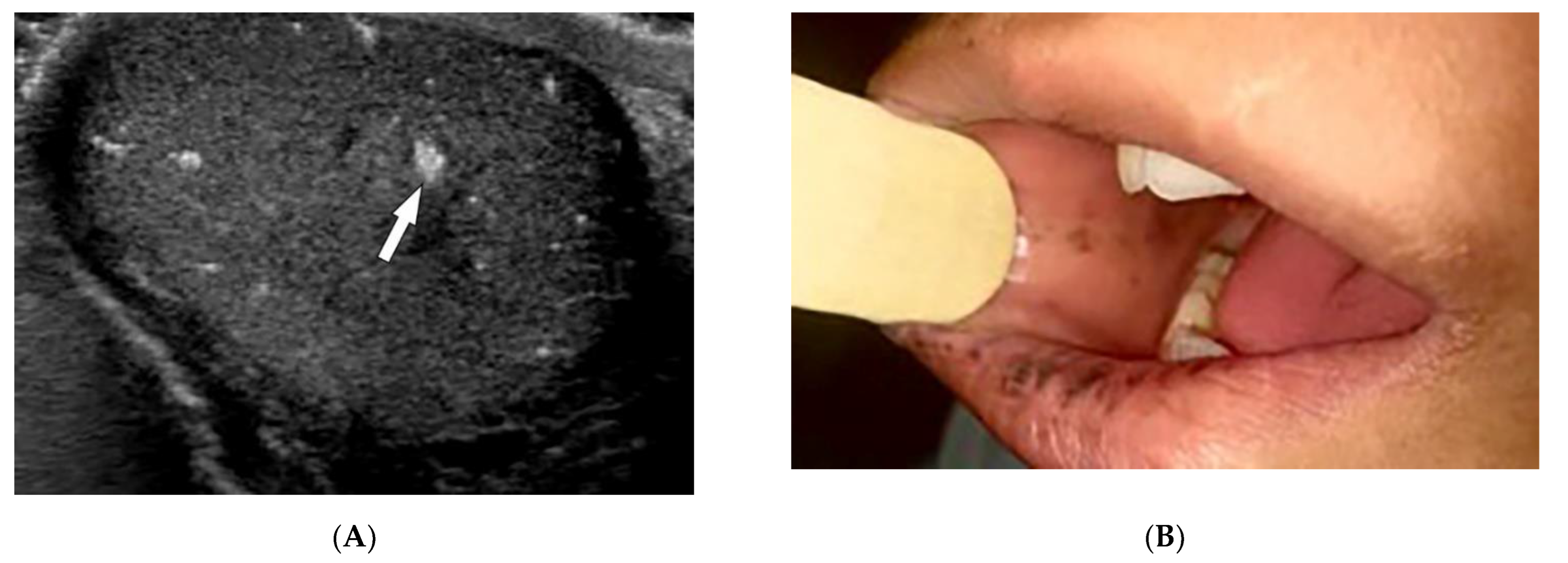 Diagnostics 12 02011 g019a Diagnostics 12 02011 g019a