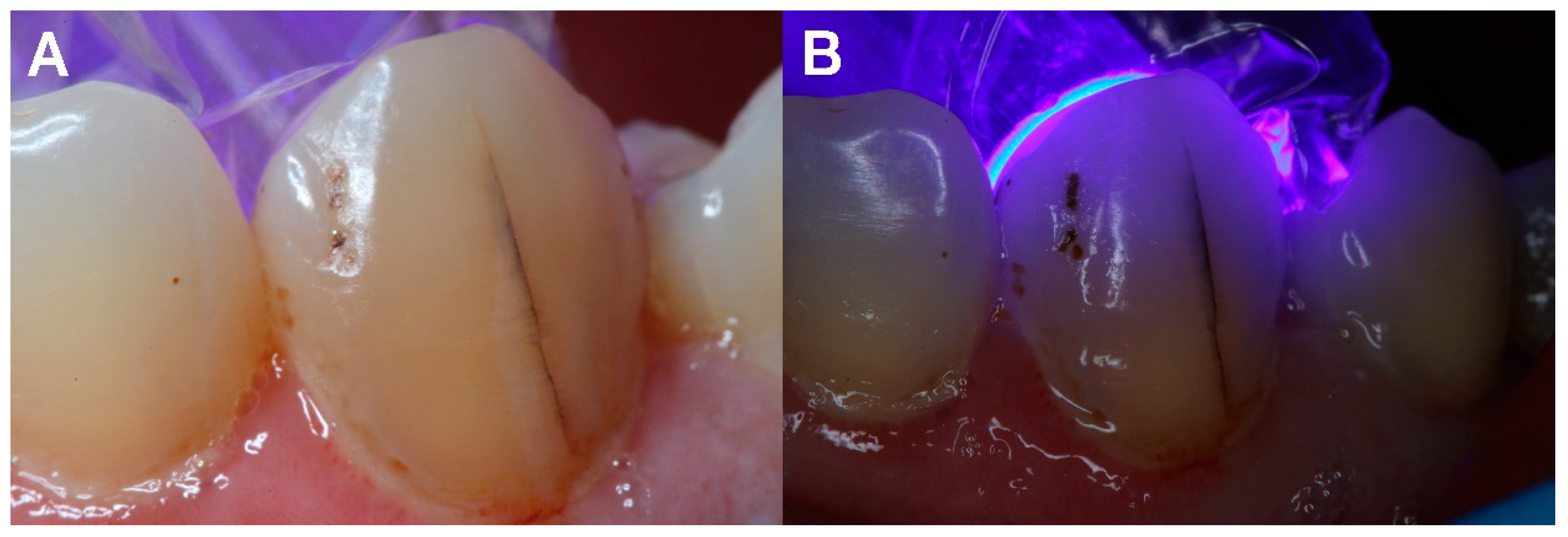 Diagnostics 12 02027 g003 Diagnostics 12 02027 g003