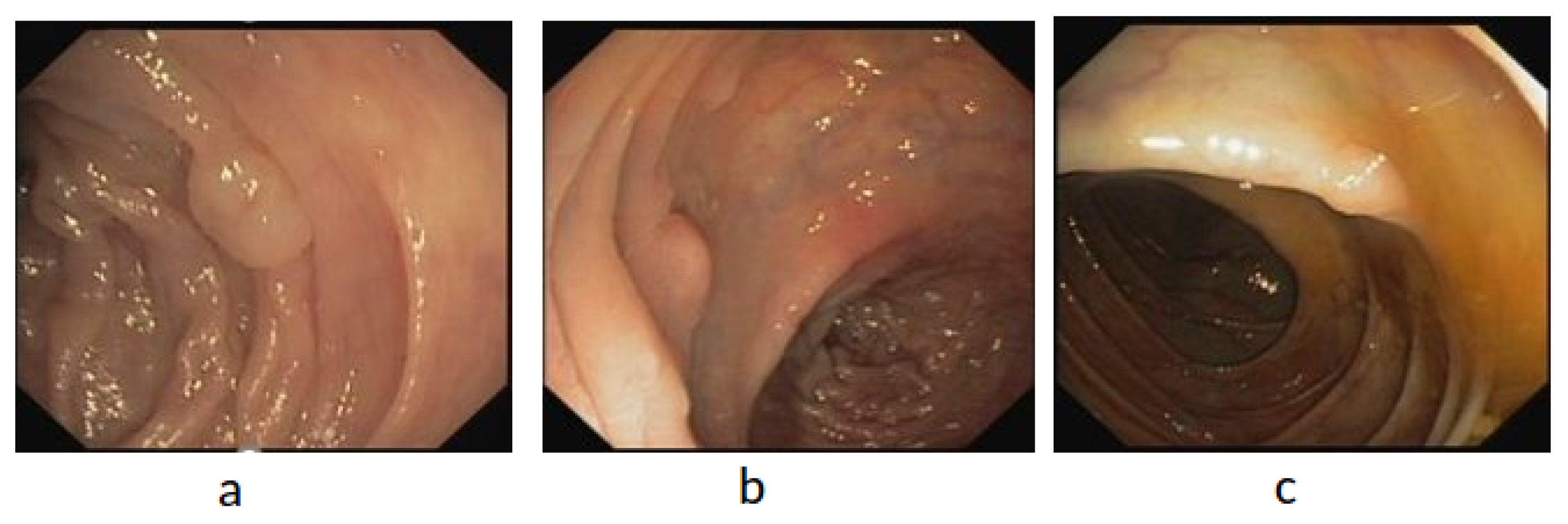 Diagnostics 12 02030 g008 550