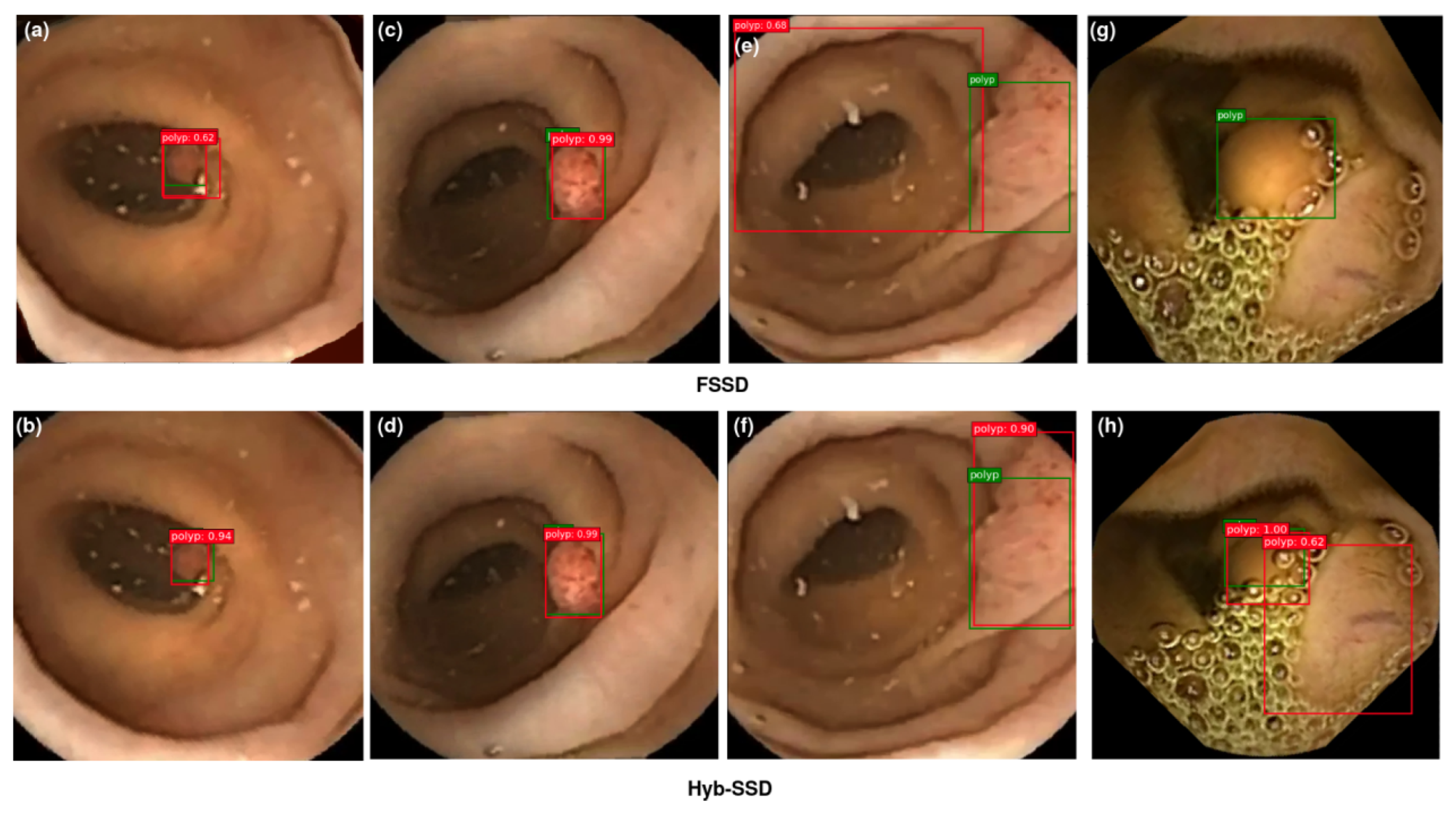 Diagnostics 12 02030 g011 550