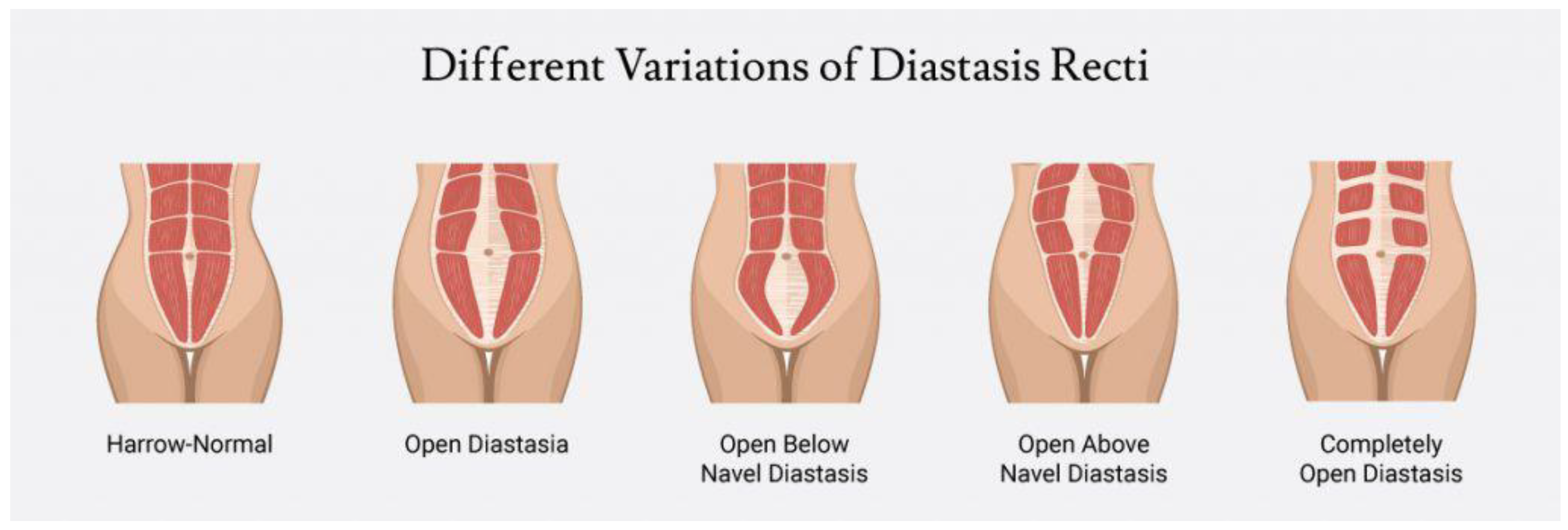 Diagnostics, Free Full-Text