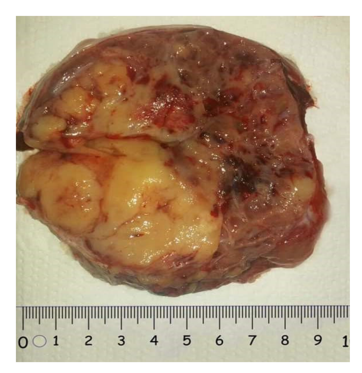 Diagnostics 12 02050 g008 550