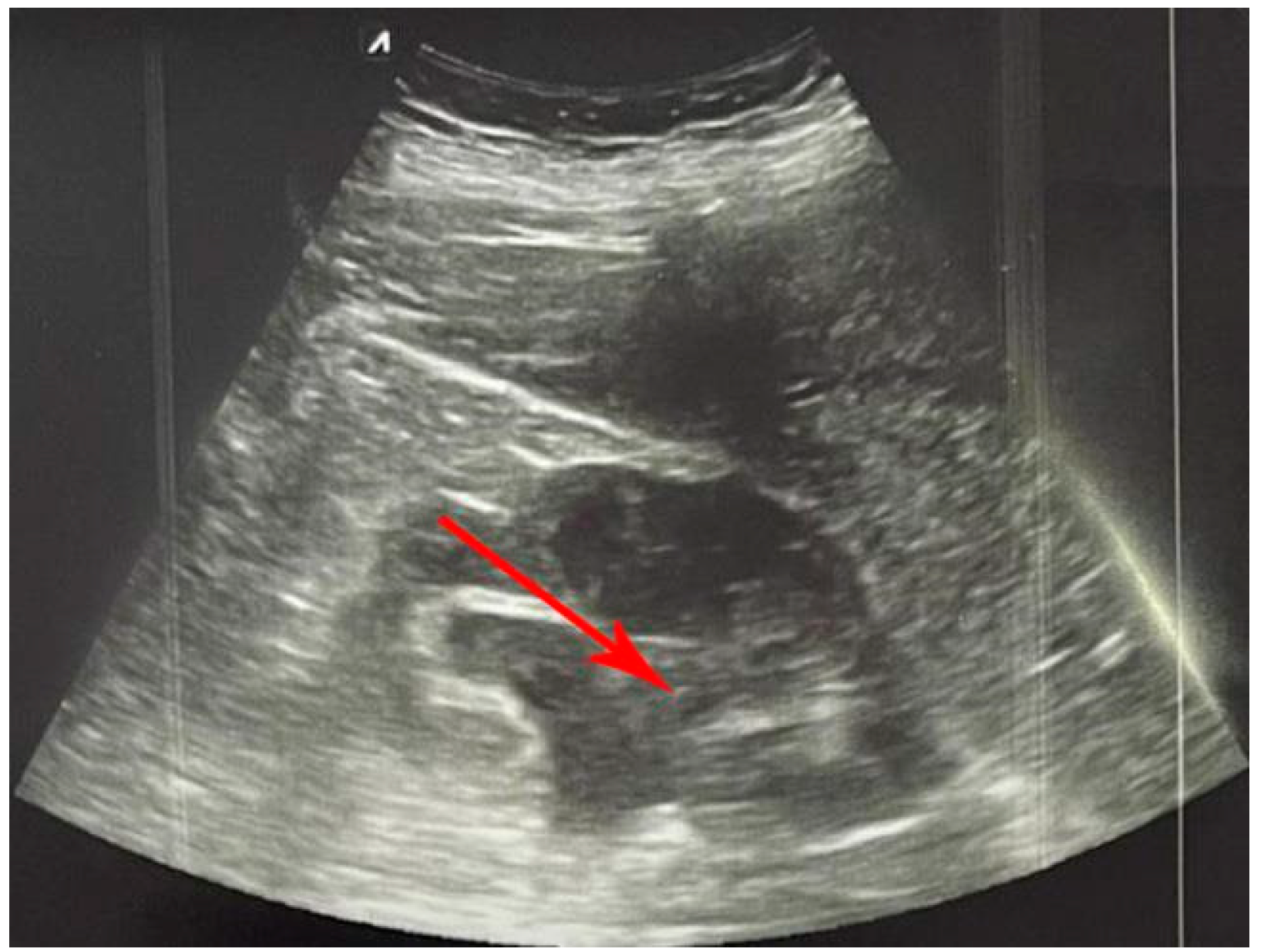 Diagnostics 12 02052 g004