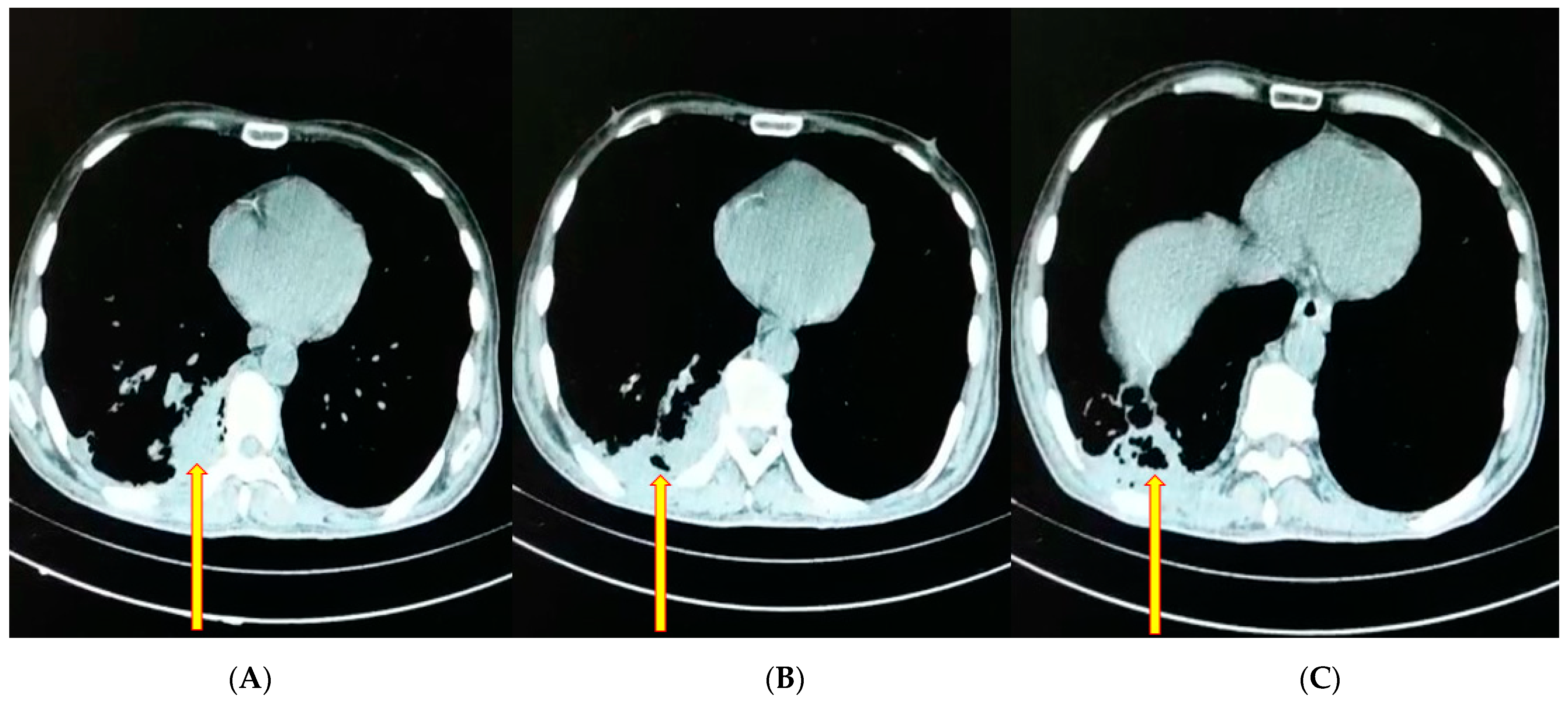 Diagnostics 12 02058 g002