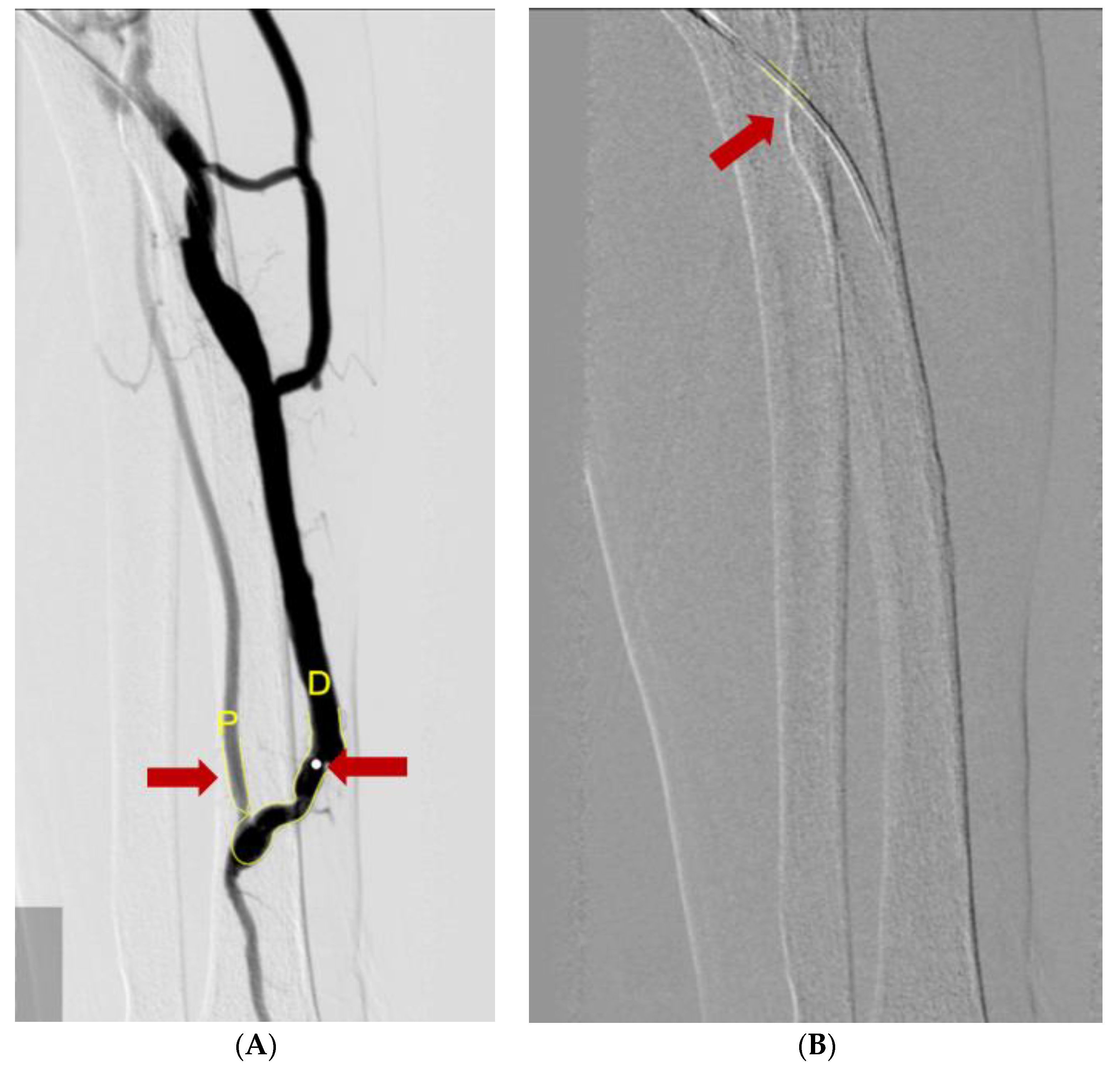 Diagnostics 12 02059 g003 550