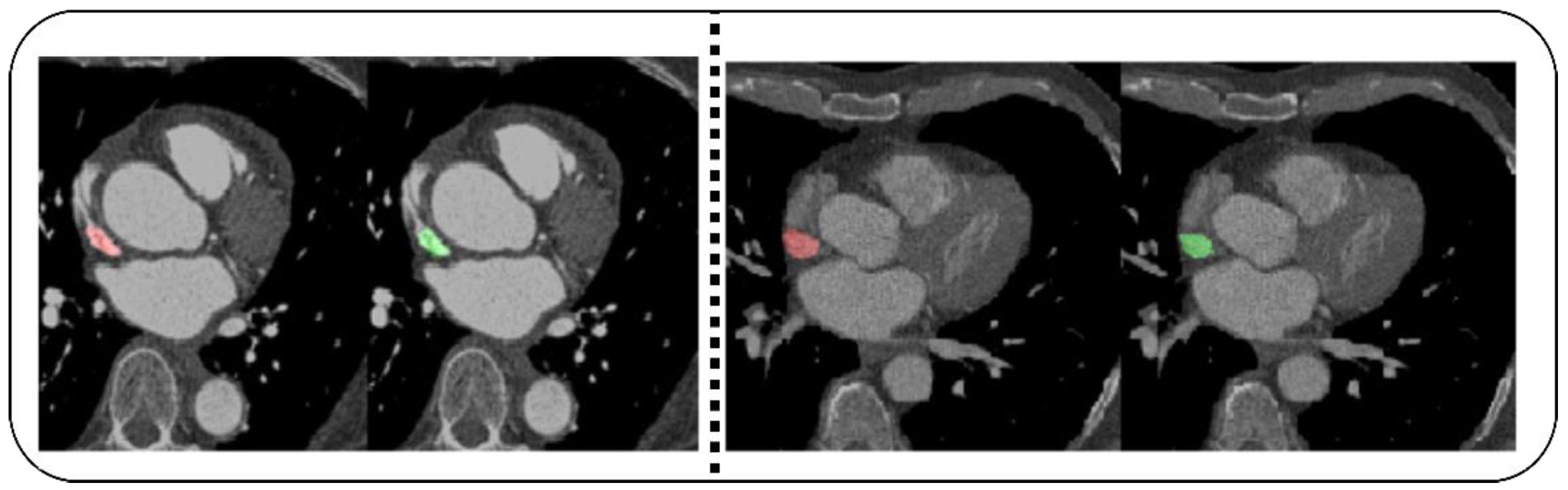 Diagnostics 12 02073 g003 550