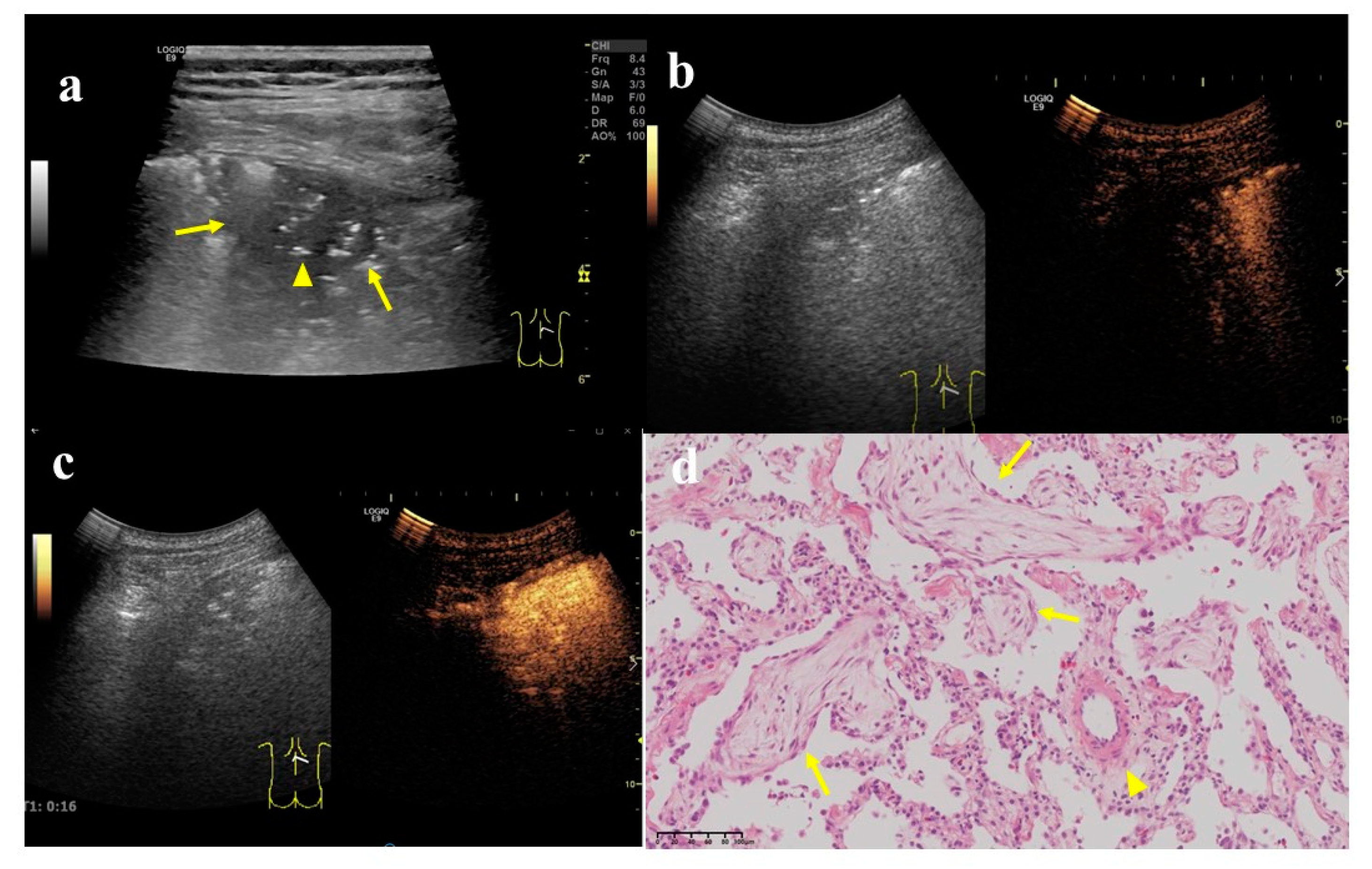 Diagnostics 12 02074 g004