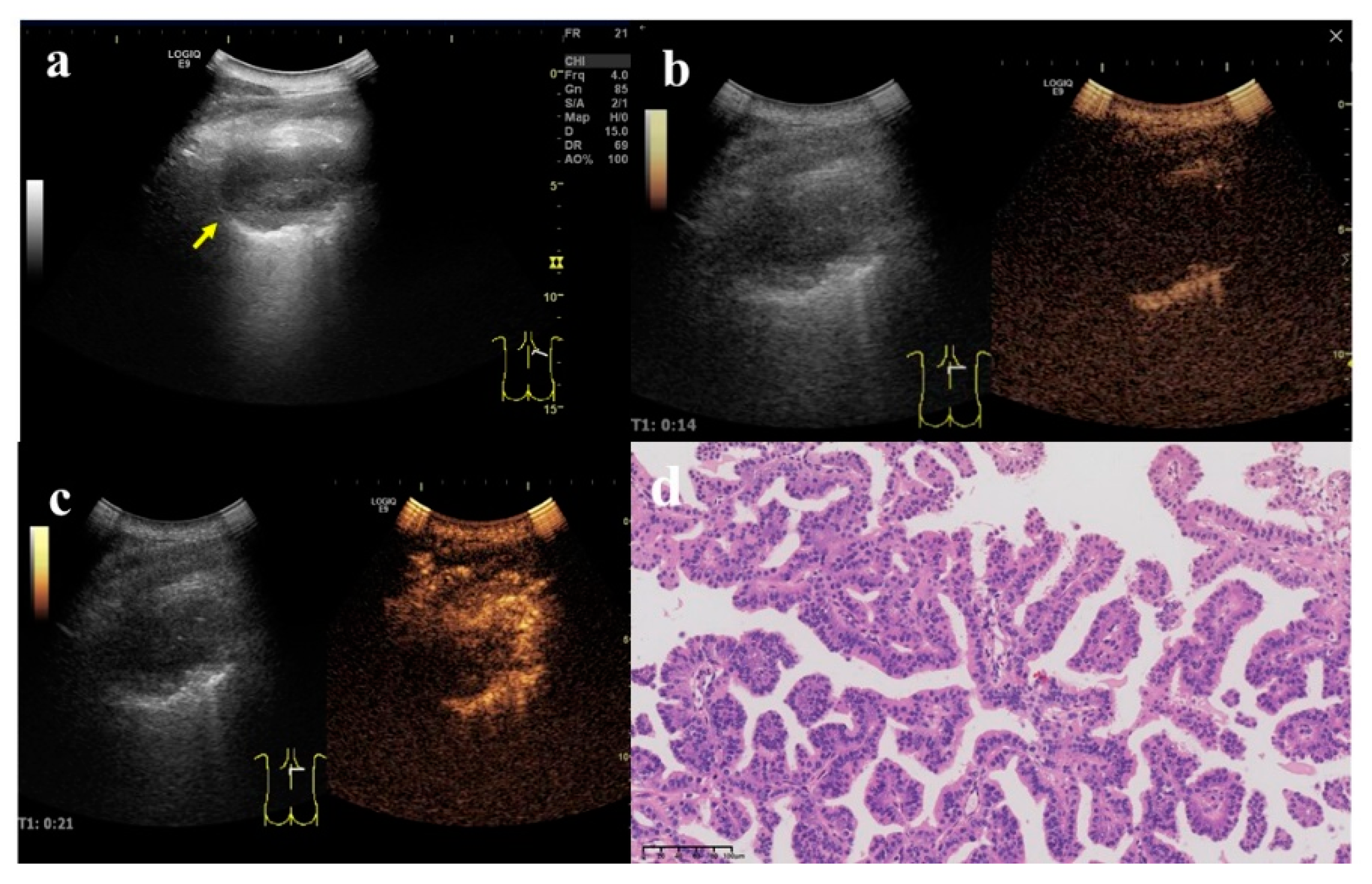 Diagnostics 12 02074 g005