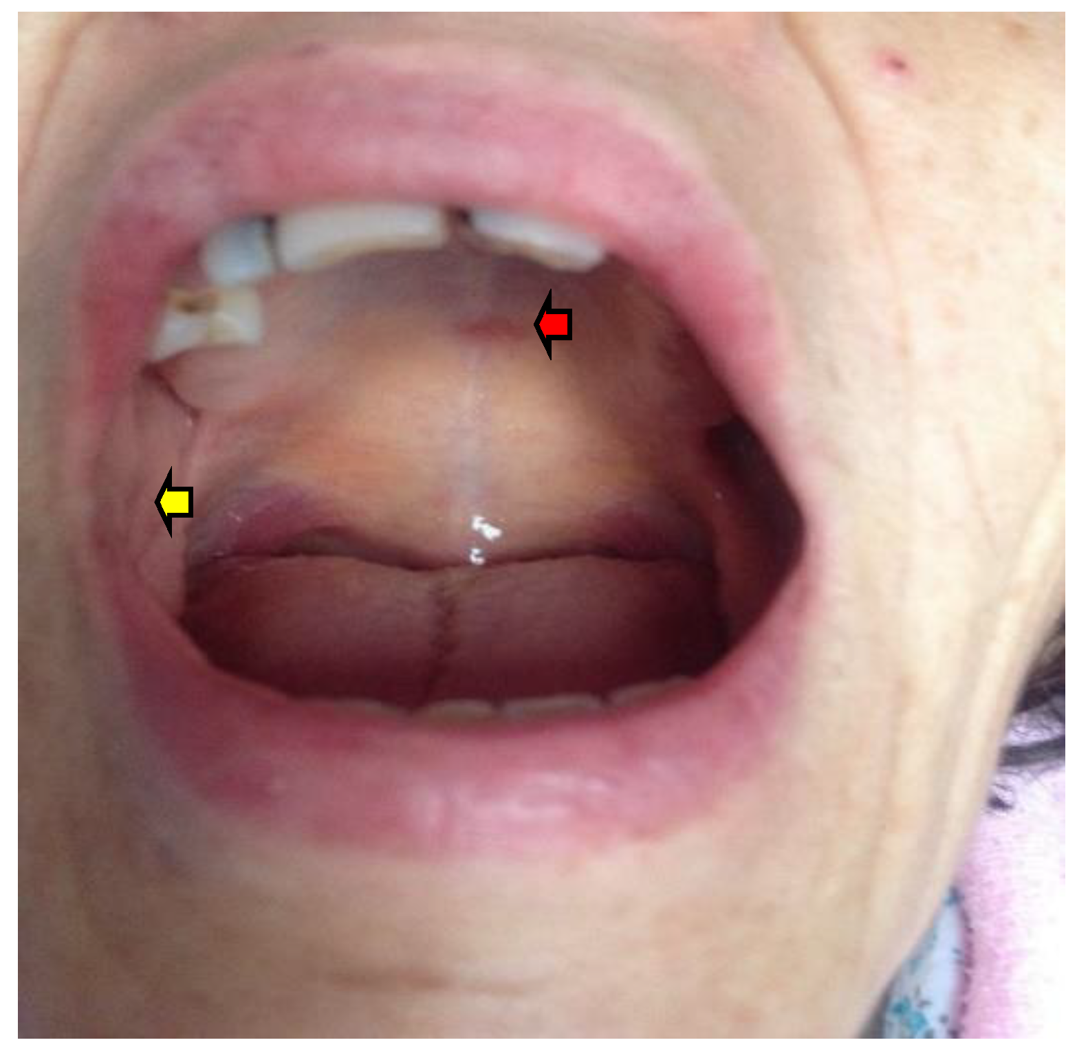 Diagnostics Free FullText New Approach to Addison Disease Oral