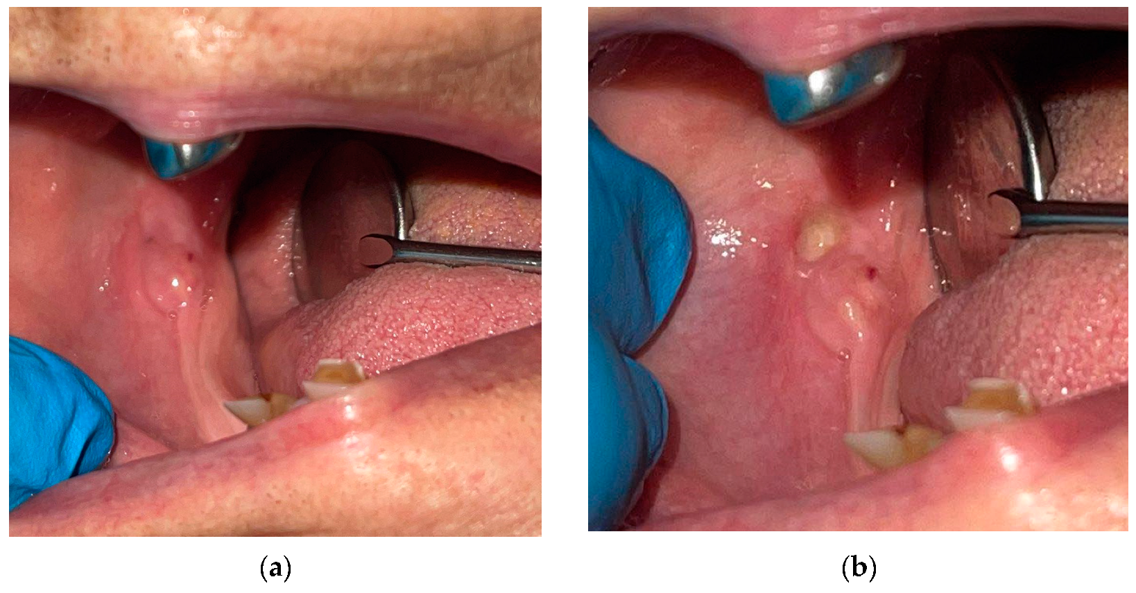 Diagnostics 12 02082 g002 Diagnostics 12 02082 g002