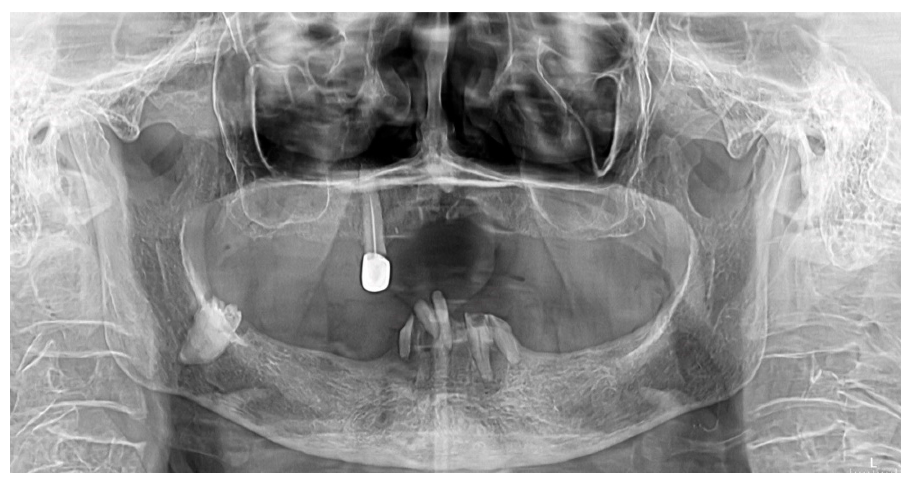 Diagnostics 12 02082 g003 Diagnostics 12 02082 g003